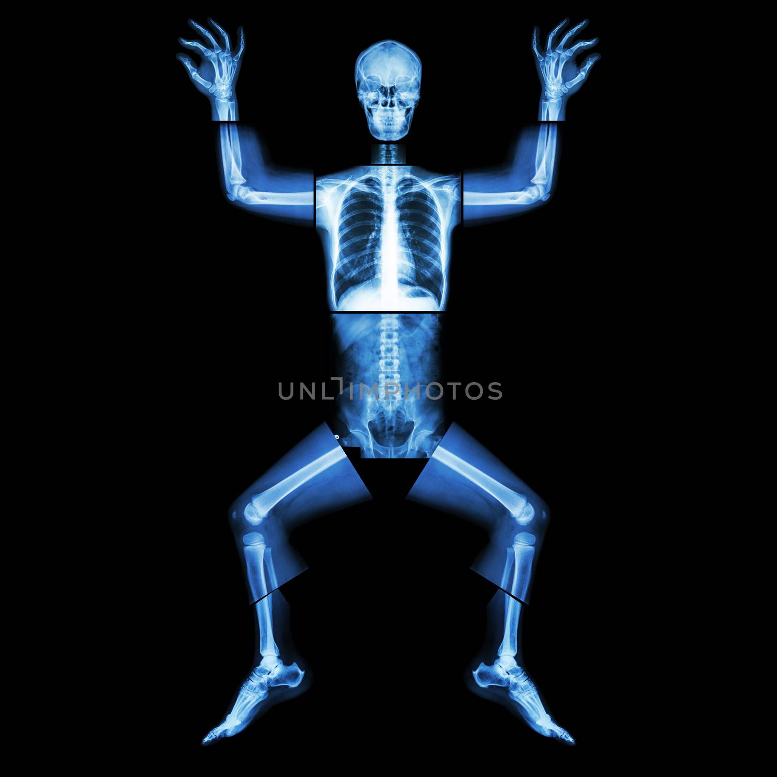 Jigsaw human x-ray ( whole body : head skull face neck spine shoulder arm elbow joint forearm wrist hand finger chest thorax heart lung rib abdomen back pelvis hip thigh knee leg ankle foot heel toe ) by stockdevil