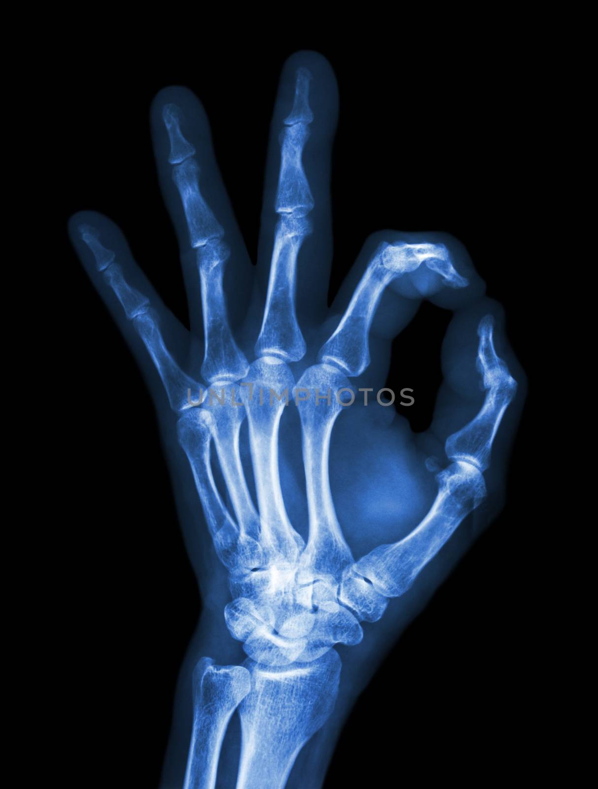 X-ray hand with OK symbol by stockdevil