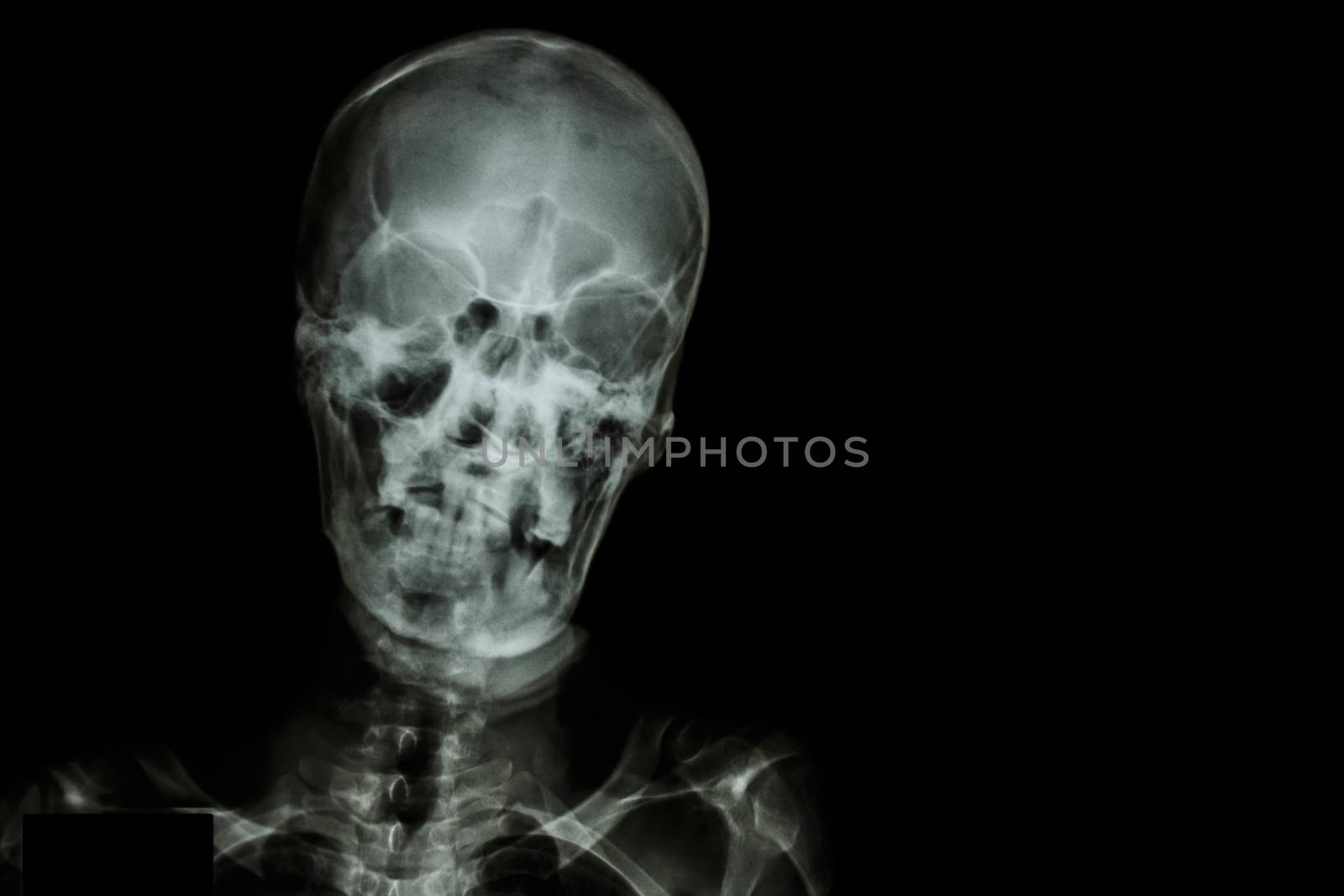 Film X-ray skull and blank area at right side by stockdevil