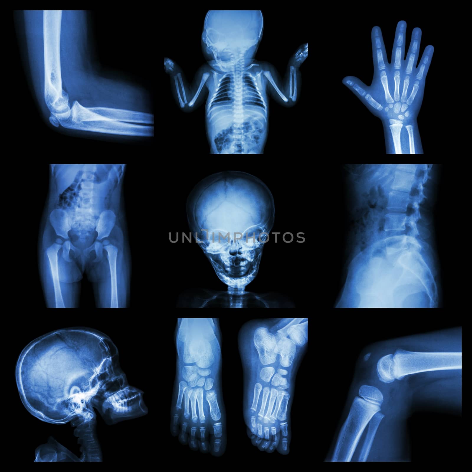 Collection X-ray part of child by stockdevil