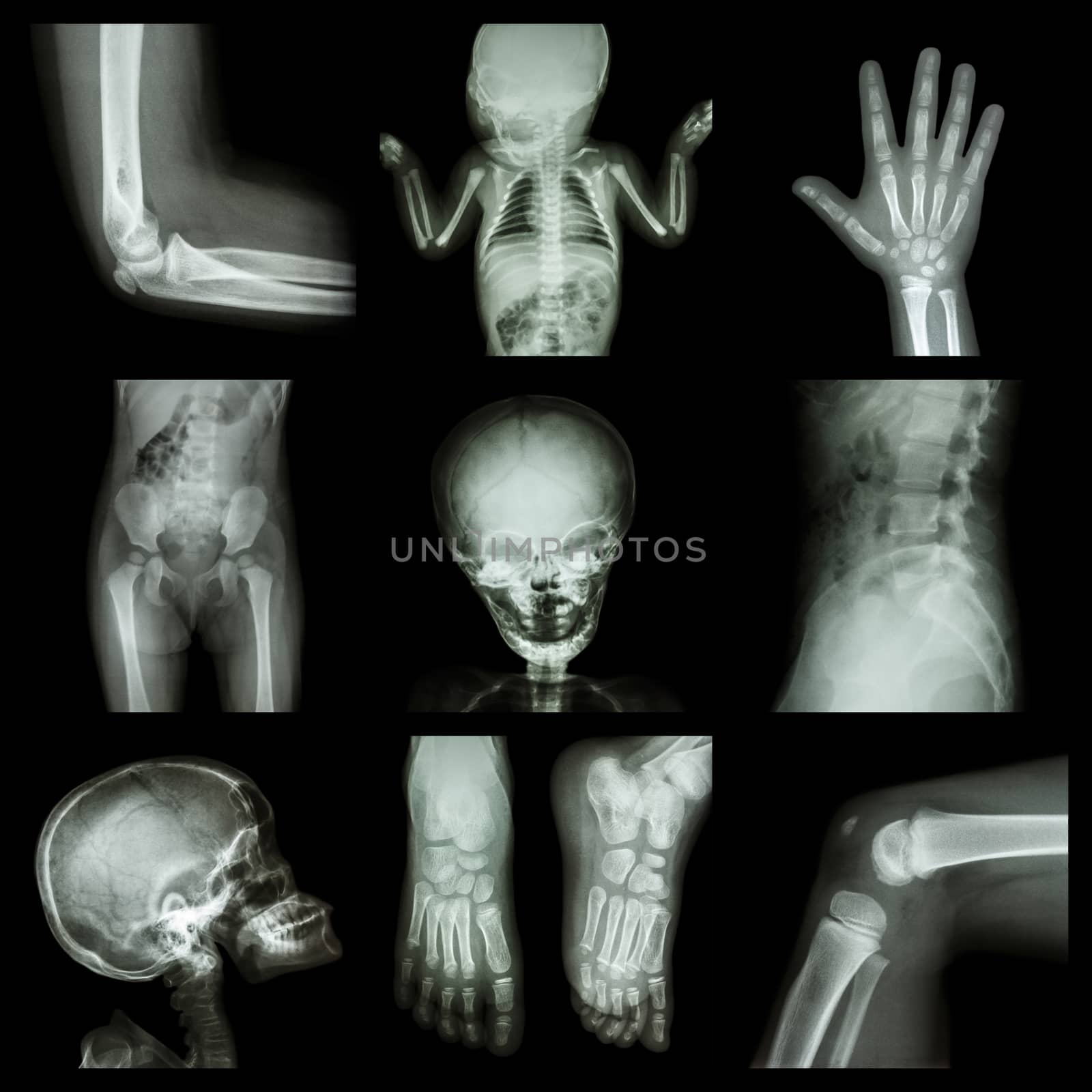 Collection X-ray part of child by stockdevil