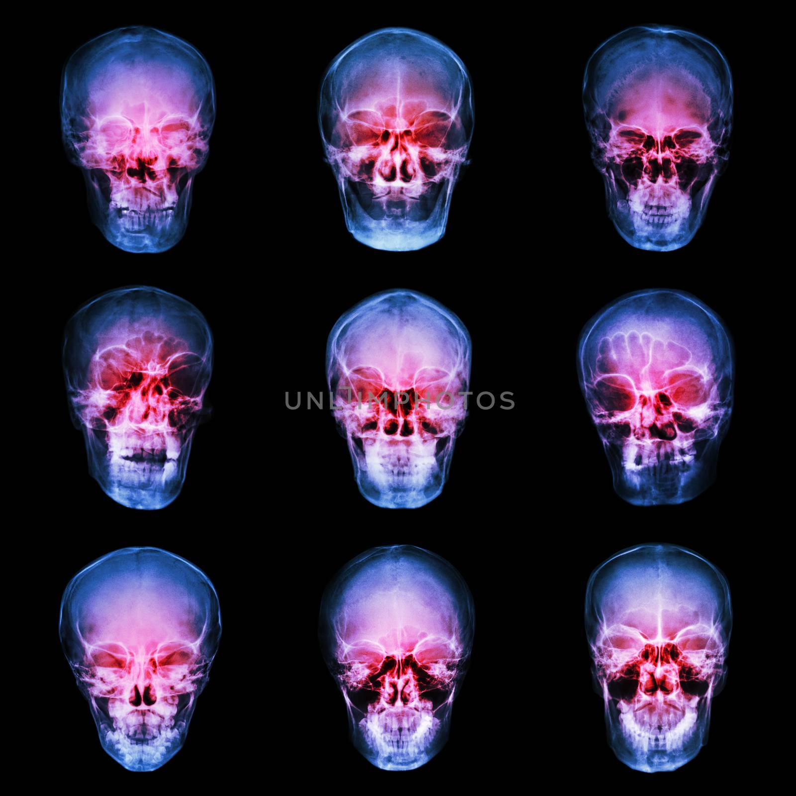 Collection of asian's skull by stockdevil