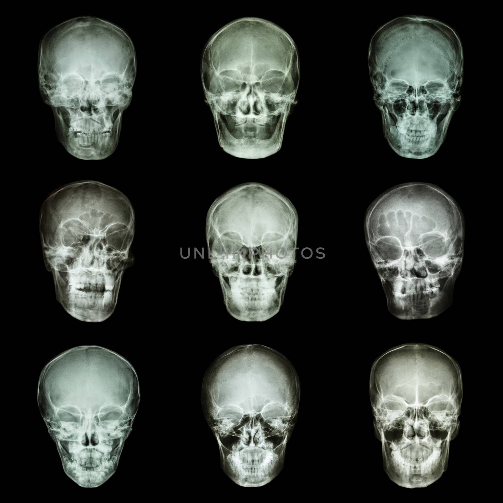 Collection of asian's skull by stockdevil