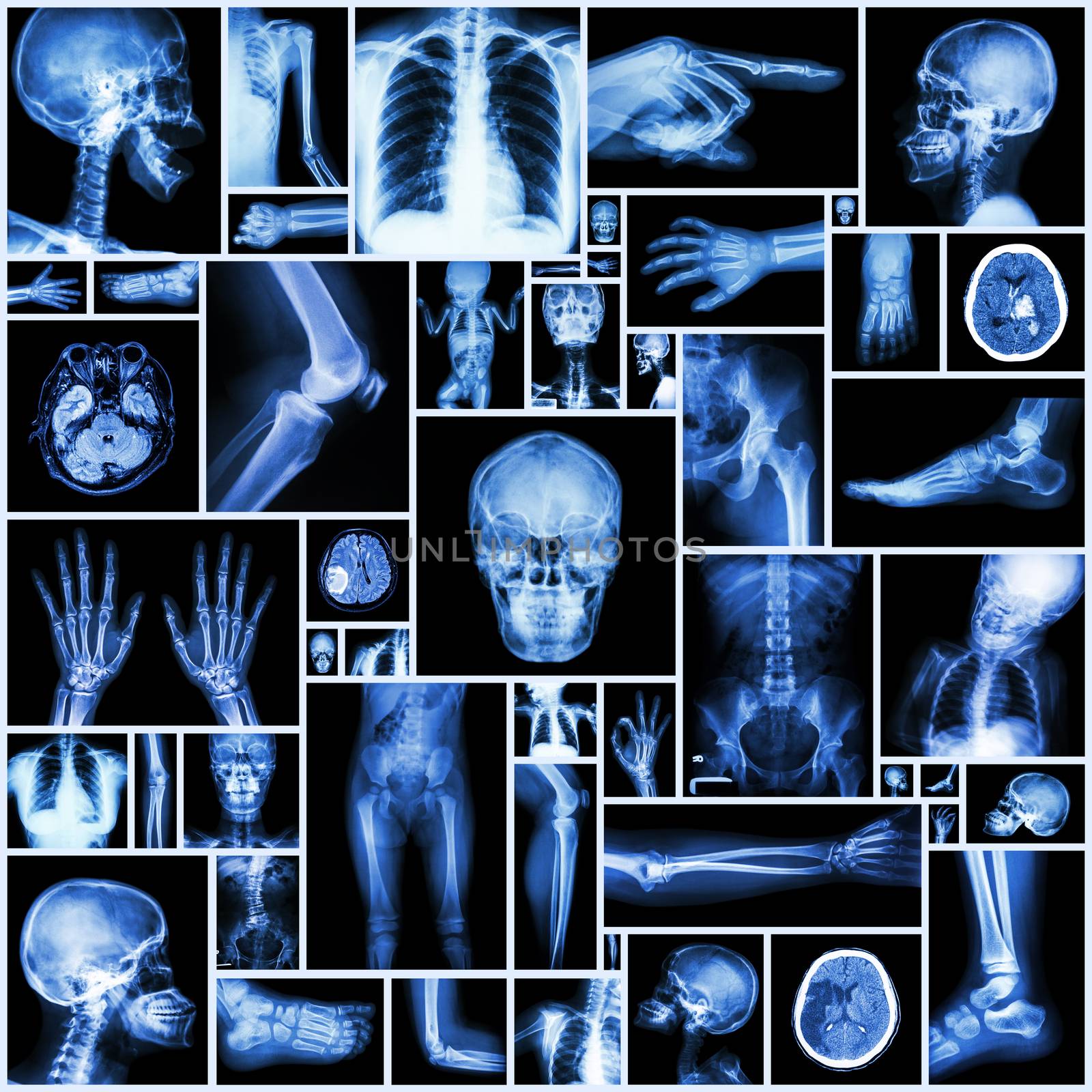 Collection X-ray multiple part of human by stockdevil