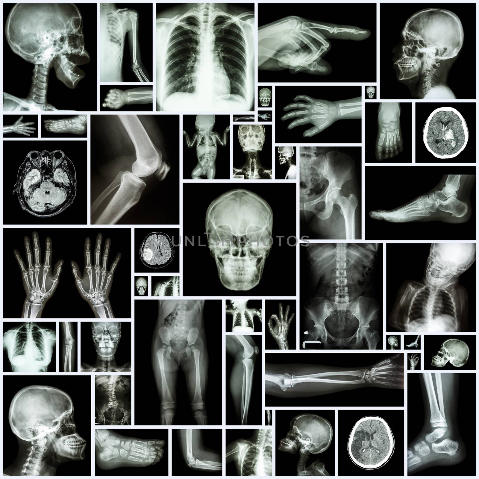 Collection X-ray multiple part of human by stockdevil