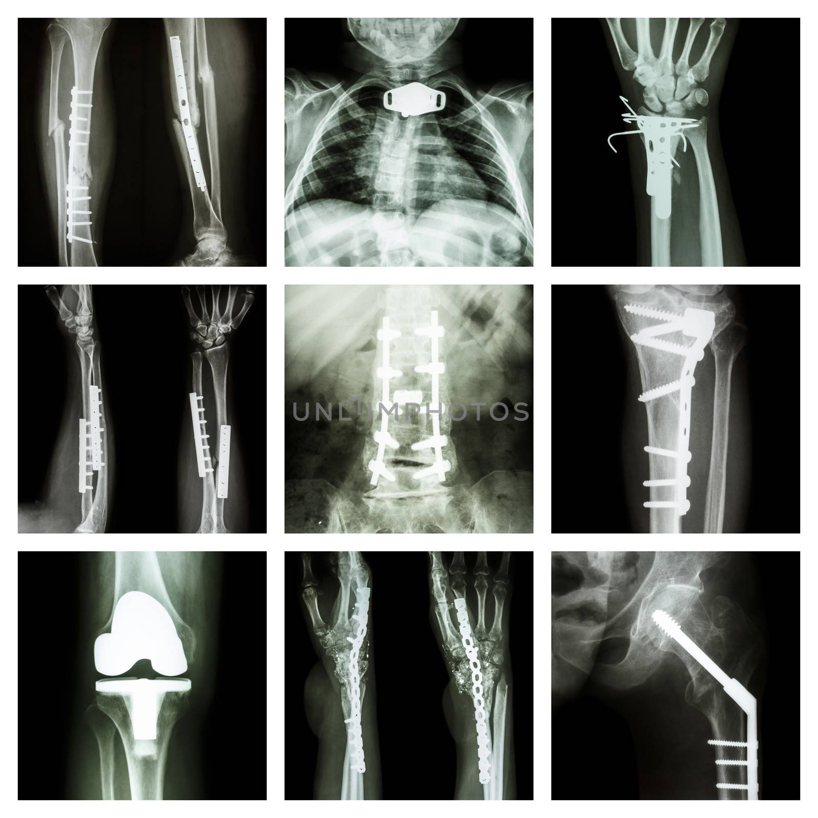 Collection of orthopedic operation by stockdevil