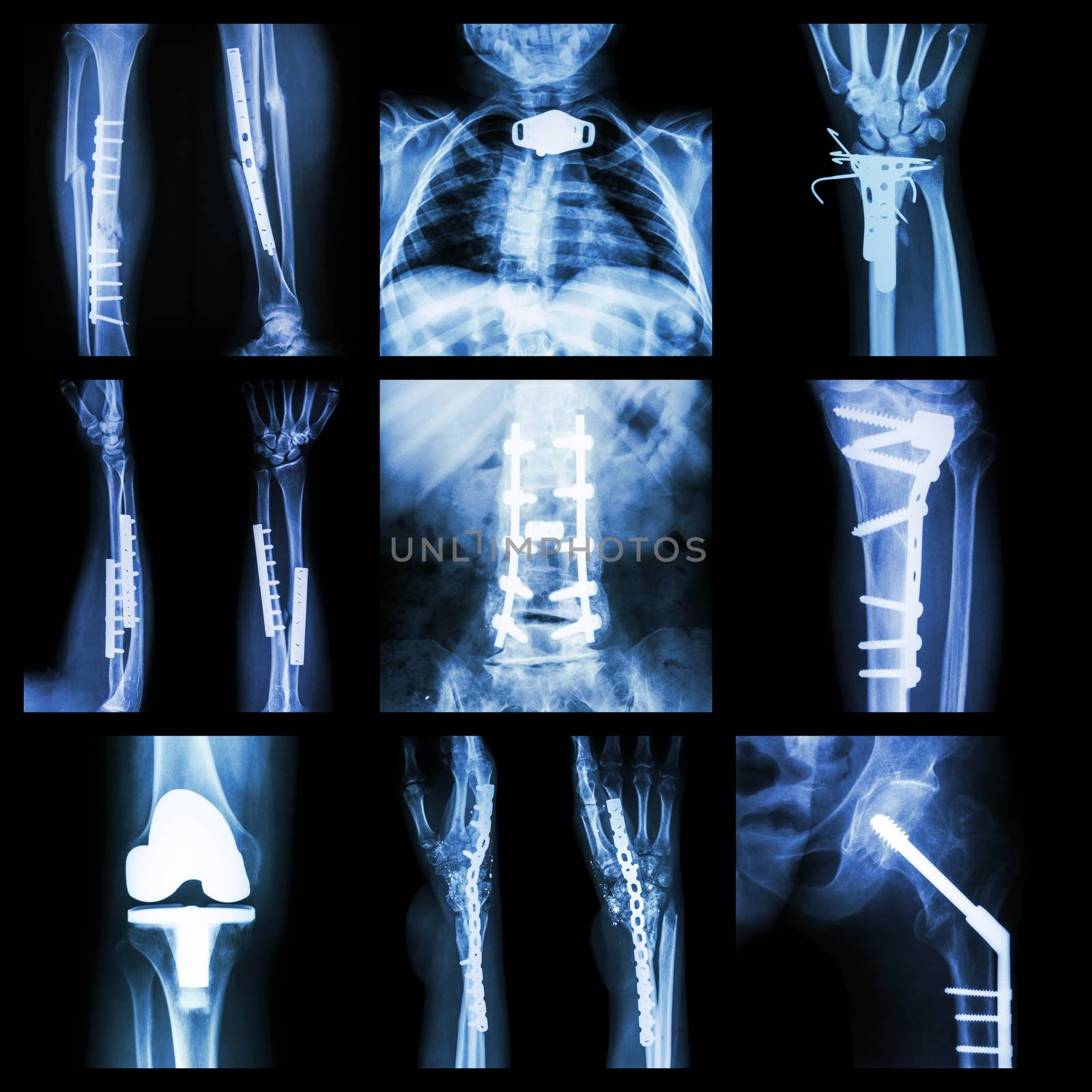 Collection of orthopedic operation by stockdevil