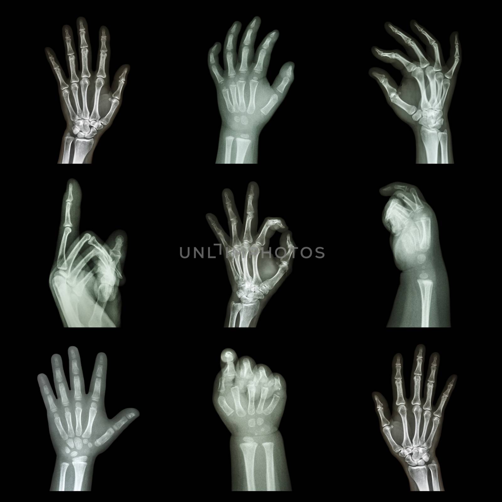 Collection x-ray of hands by stockdevil