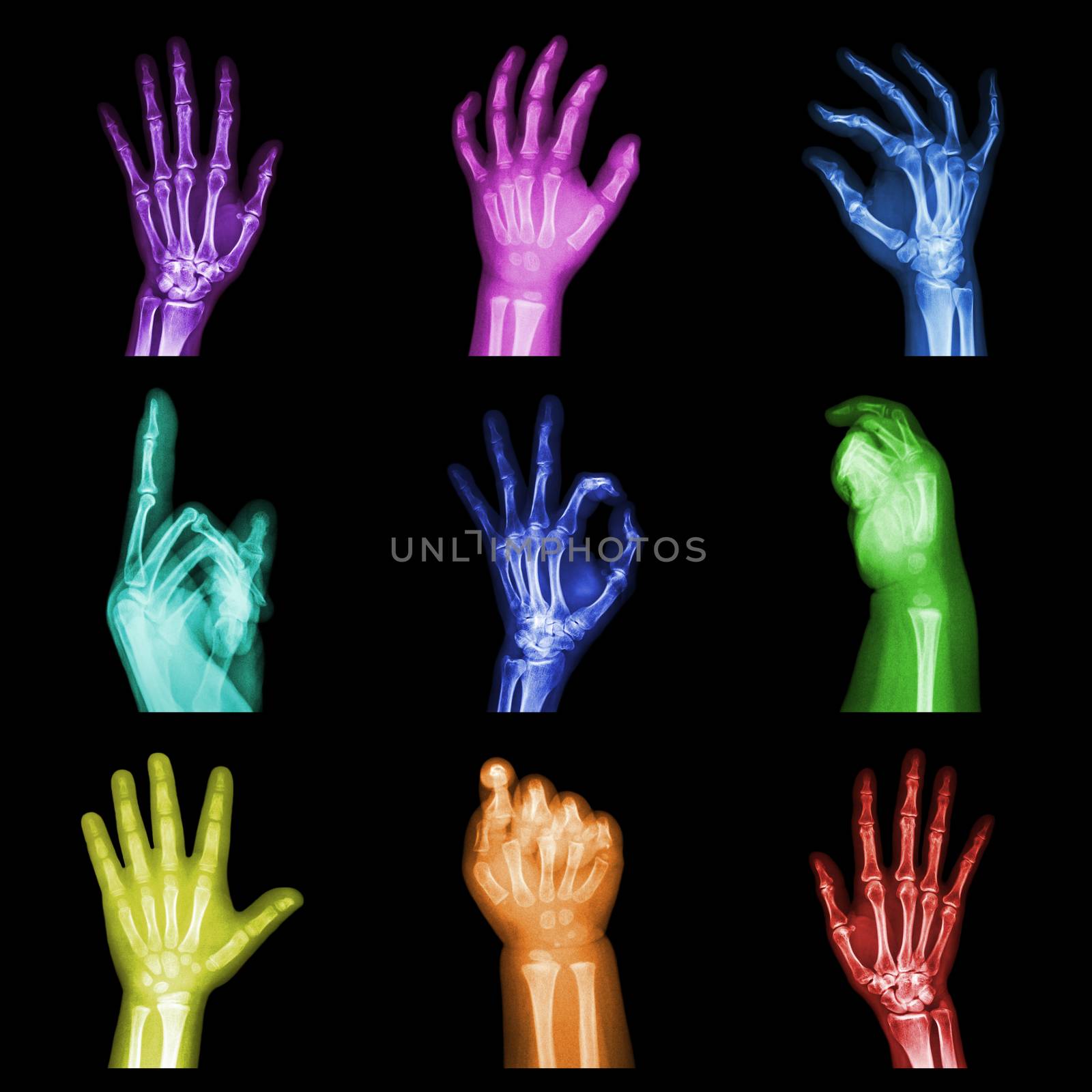 Collection of colorful x-ray hands