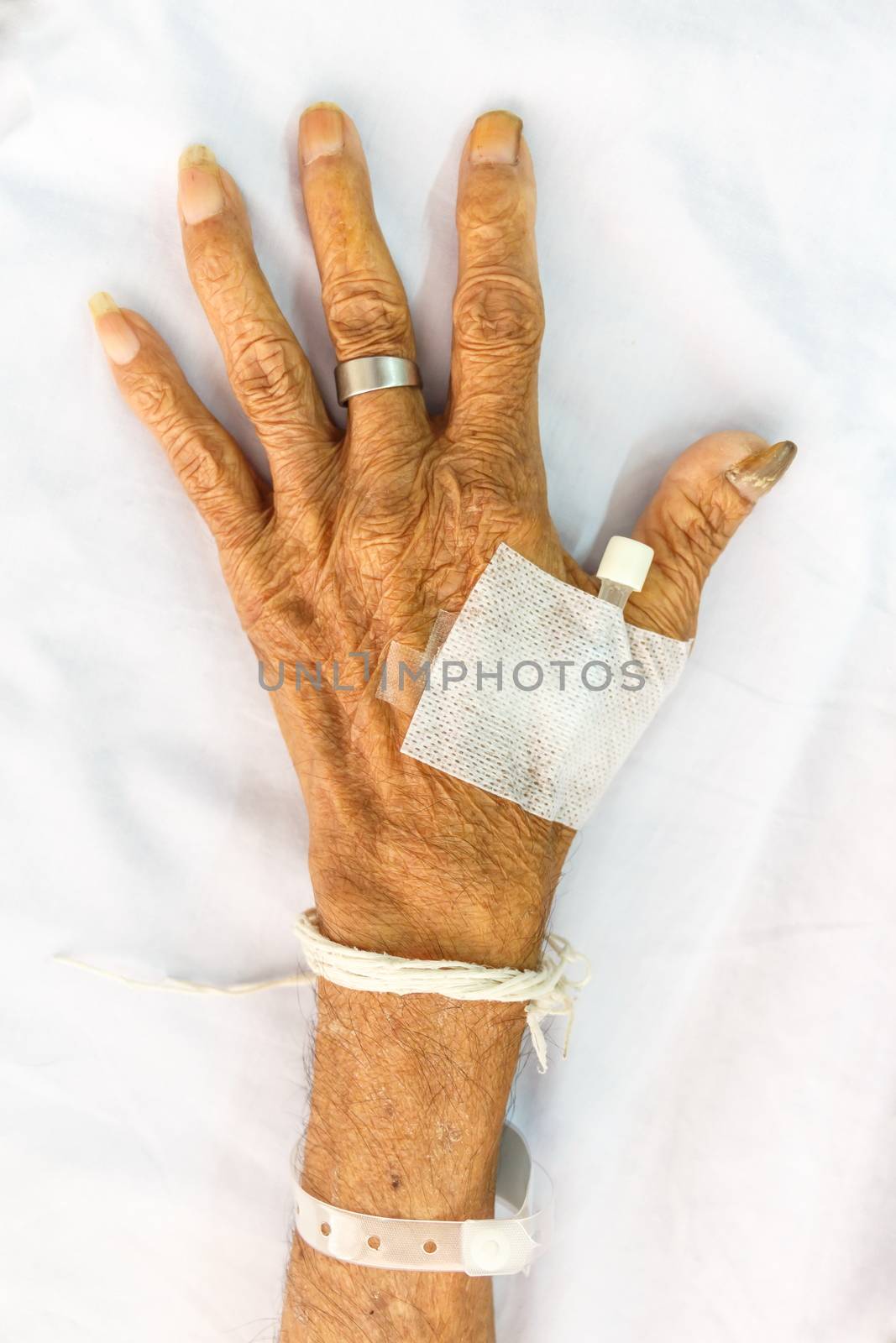 hand of old patient with plug on bed in hospital