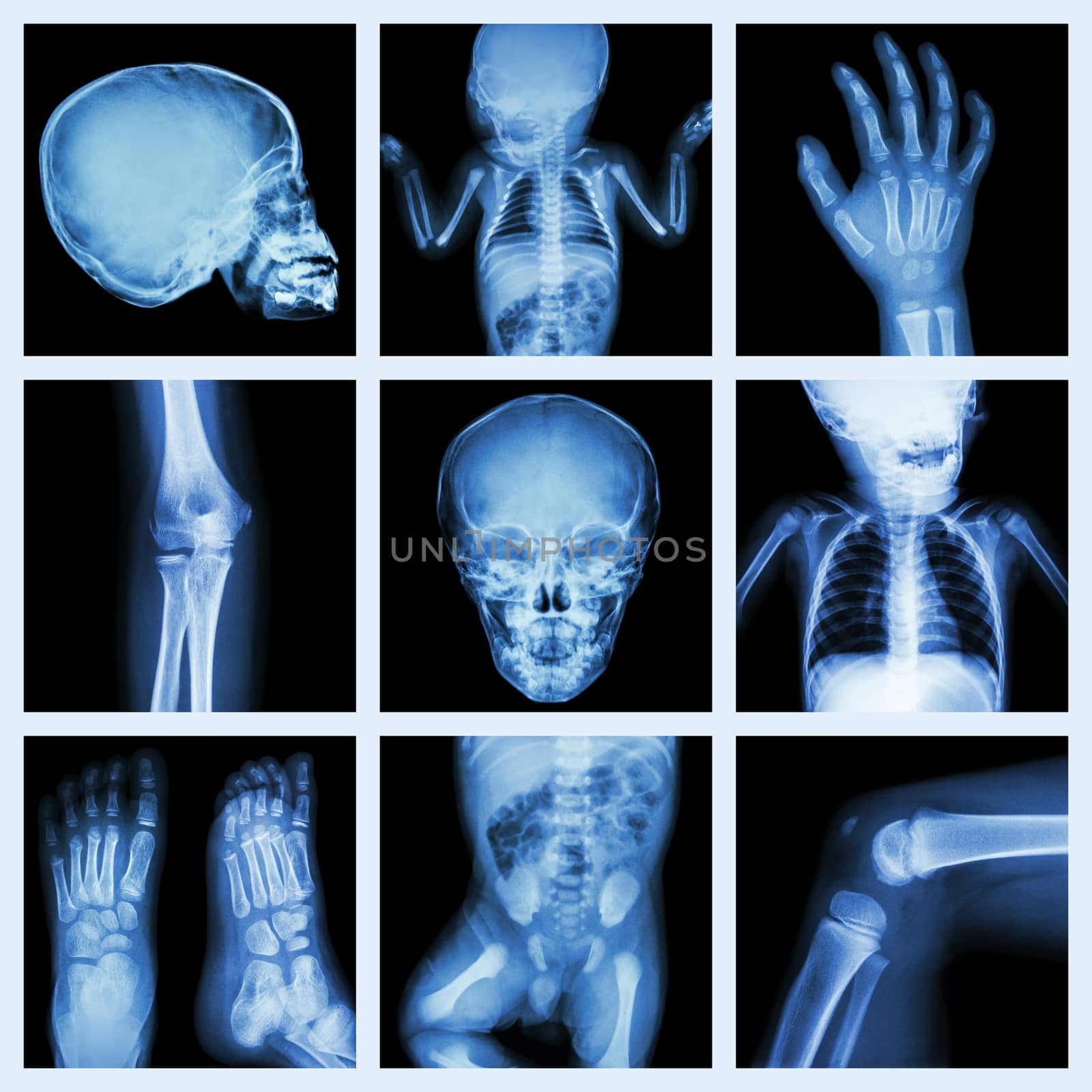 Collection x-ray part of child body (Version 2) by stockdevil