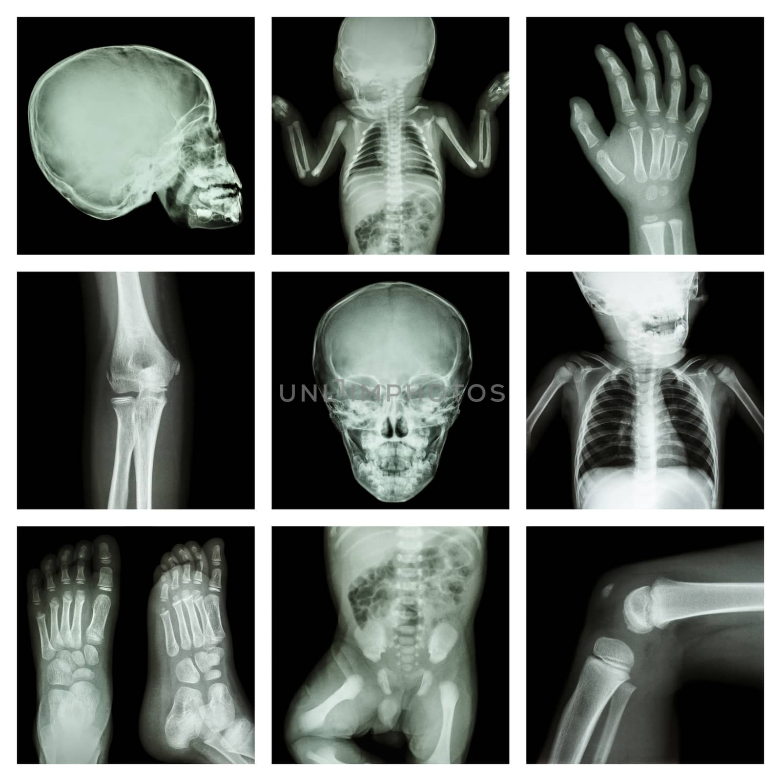 Collection x-ray part of child body (Version 2) by stockdevil