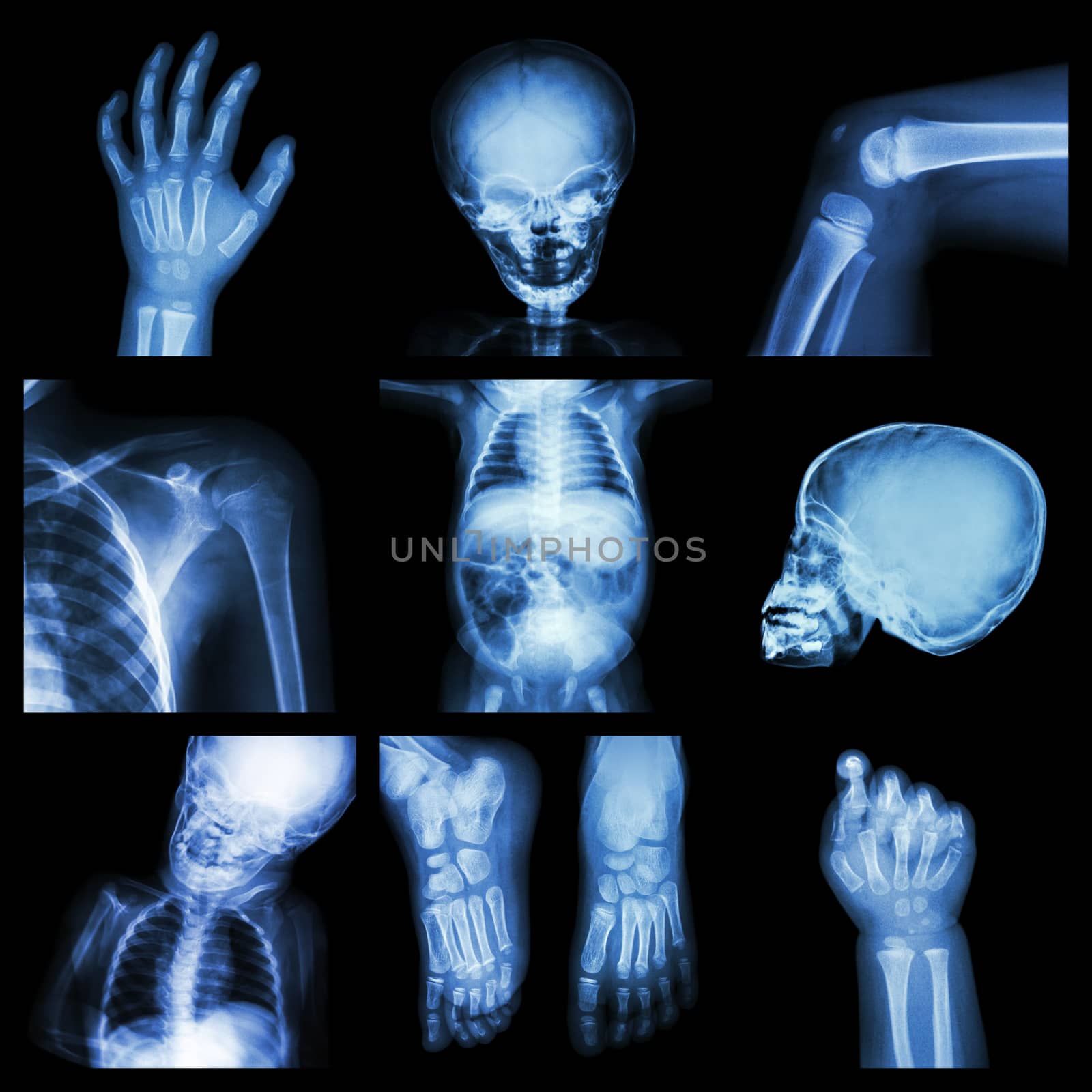 Collection x-ray part of child body by stockdevil