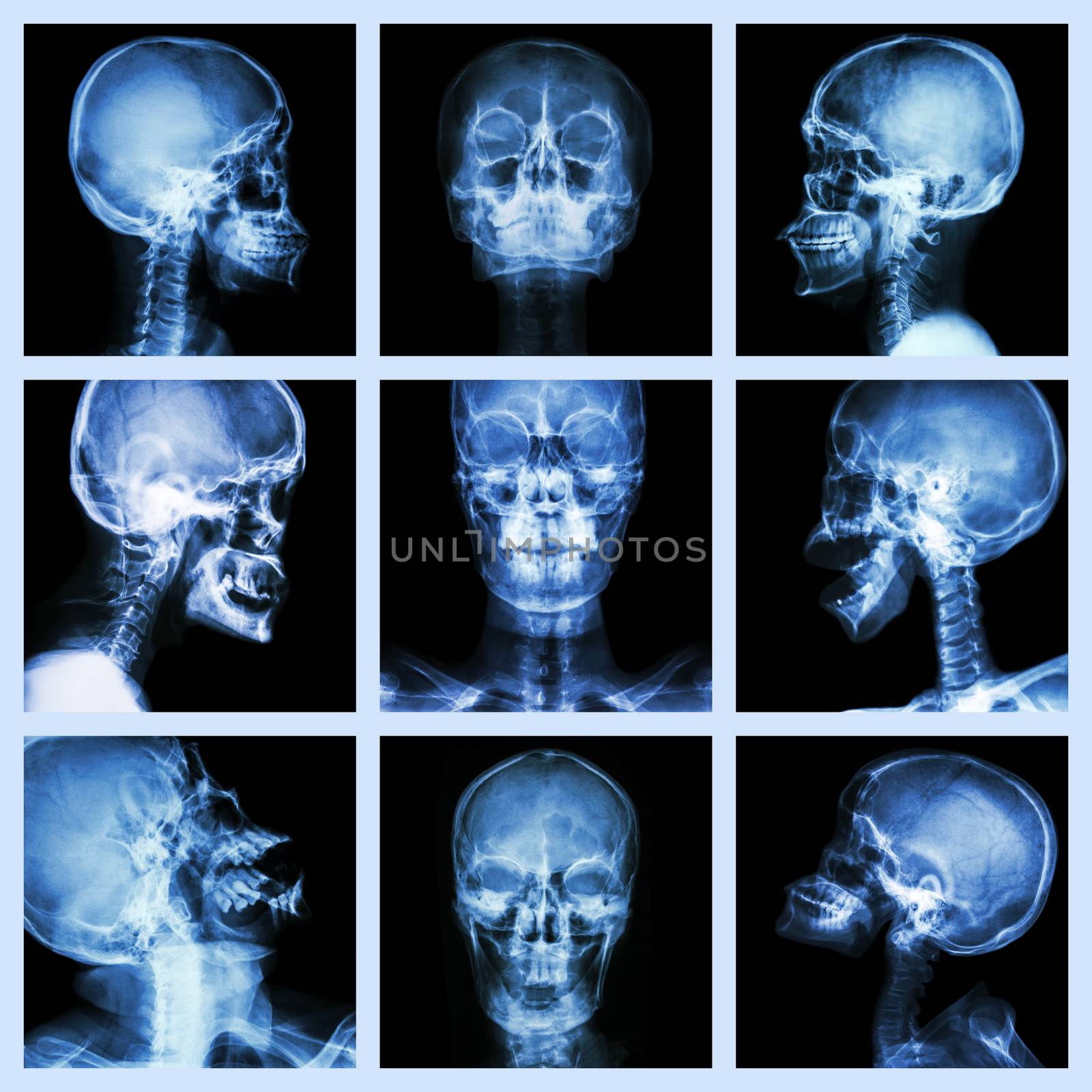 Collection of asian skull (Thai people) by stockdevil