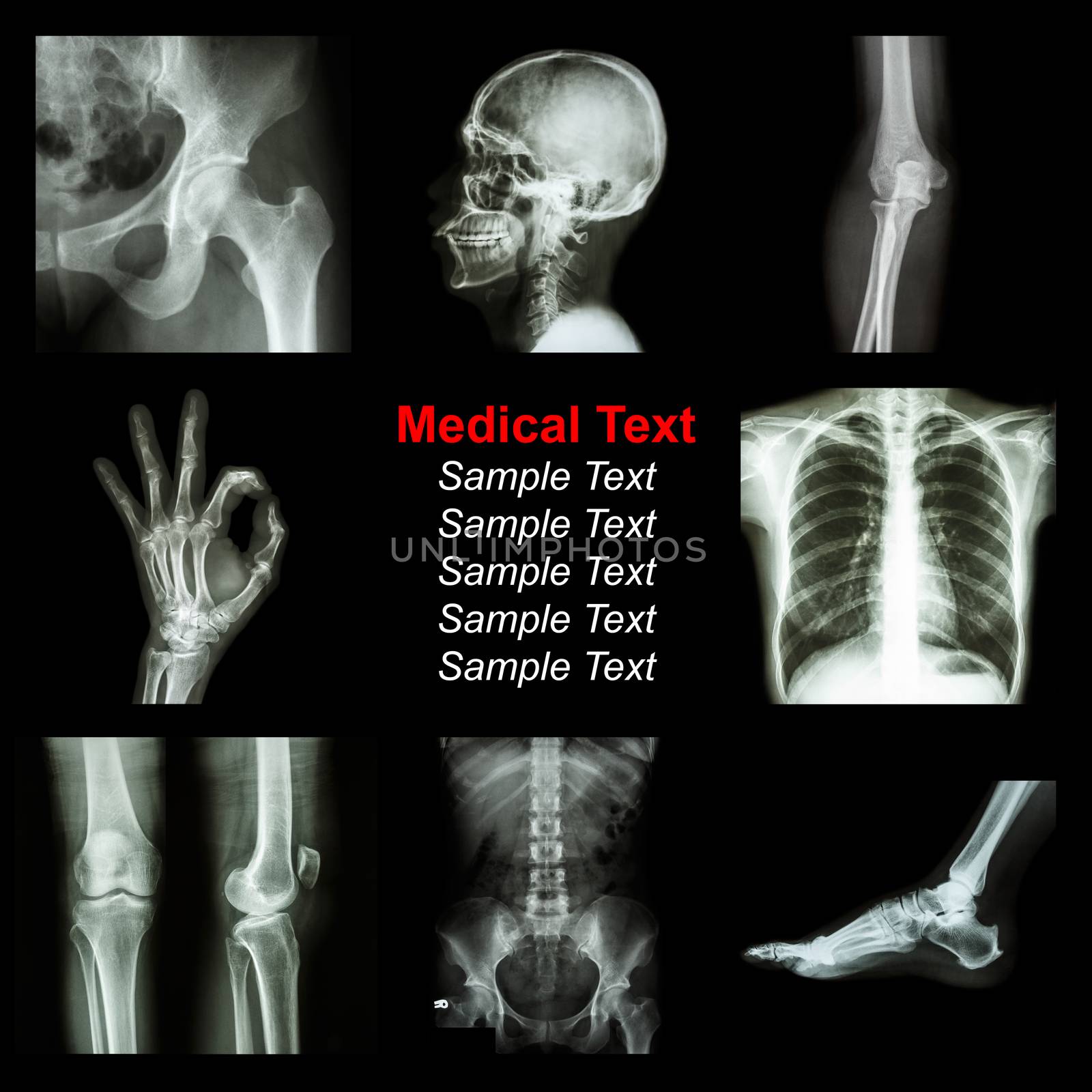 Collection of X-ray part of human