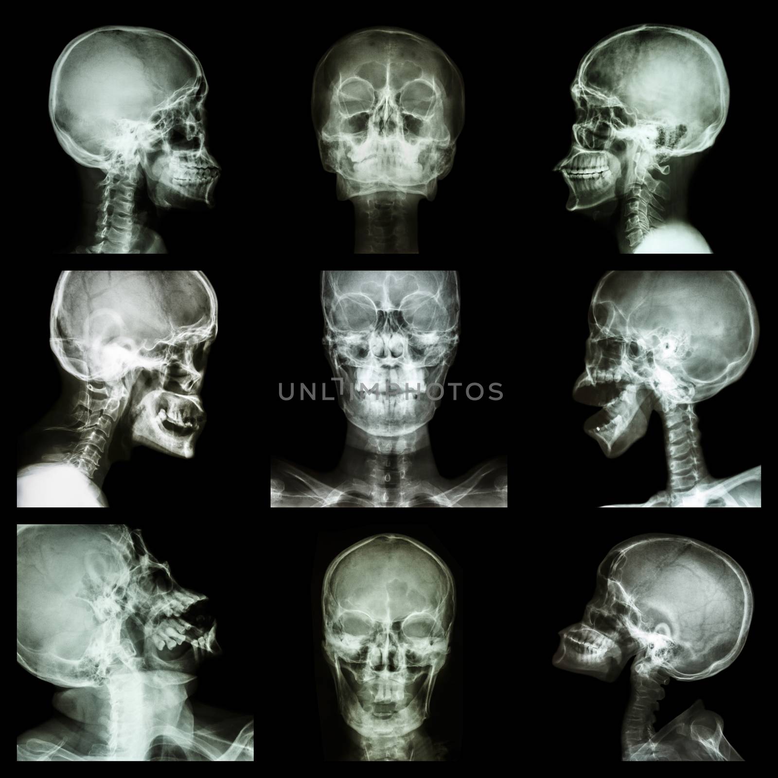 Collection of asian skull (Thai people) by stockdevil