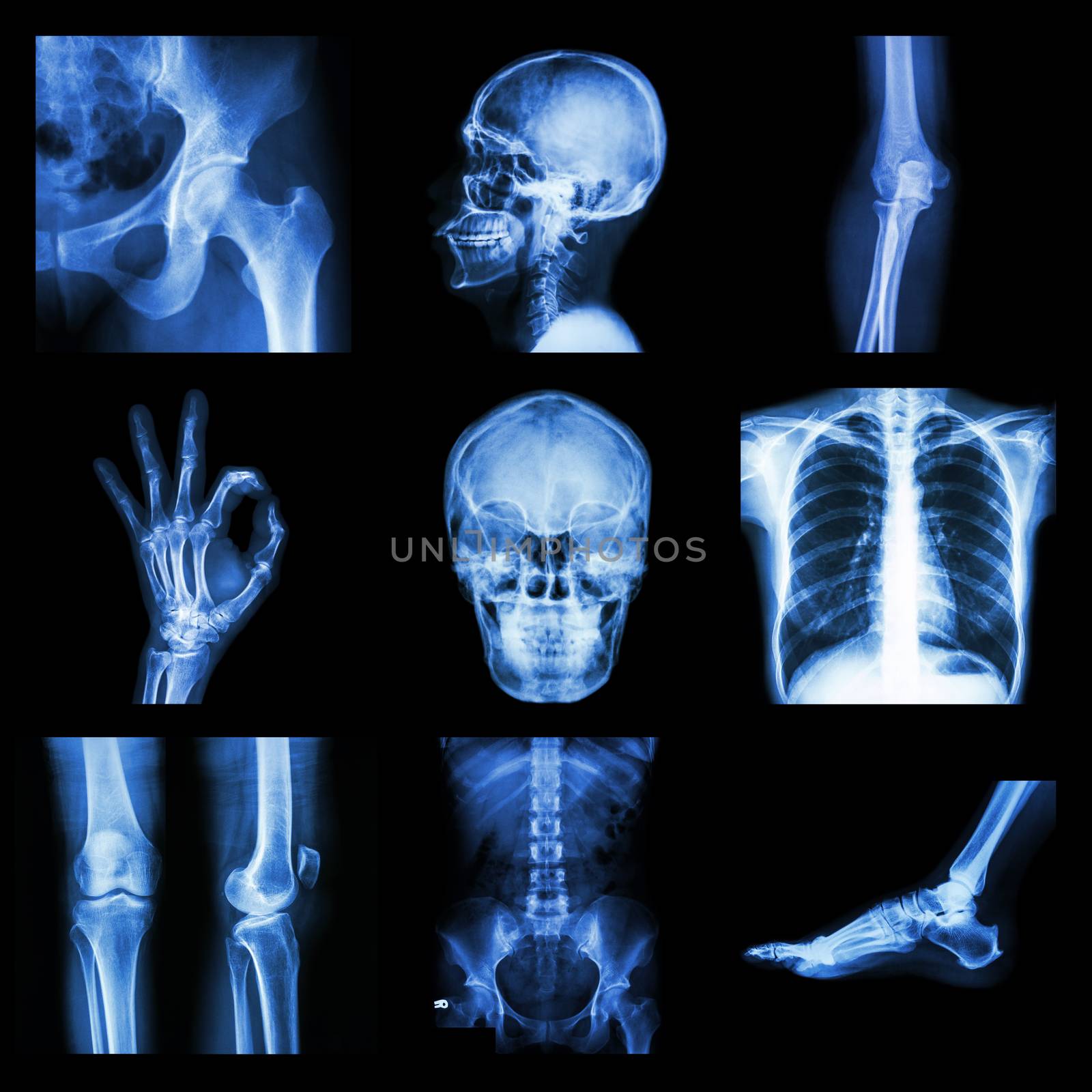 Collection X-ray part of human by stockdevil