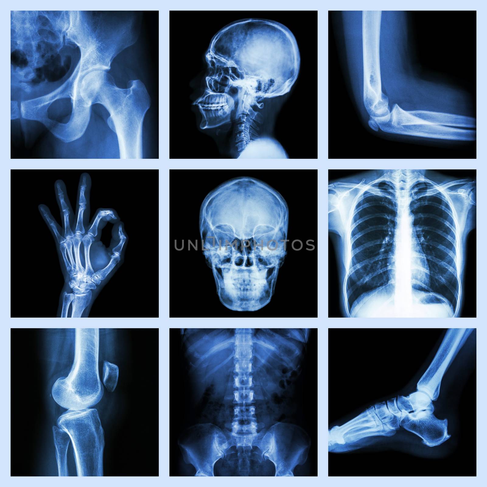 Collection X-ray part of human by stockdevil