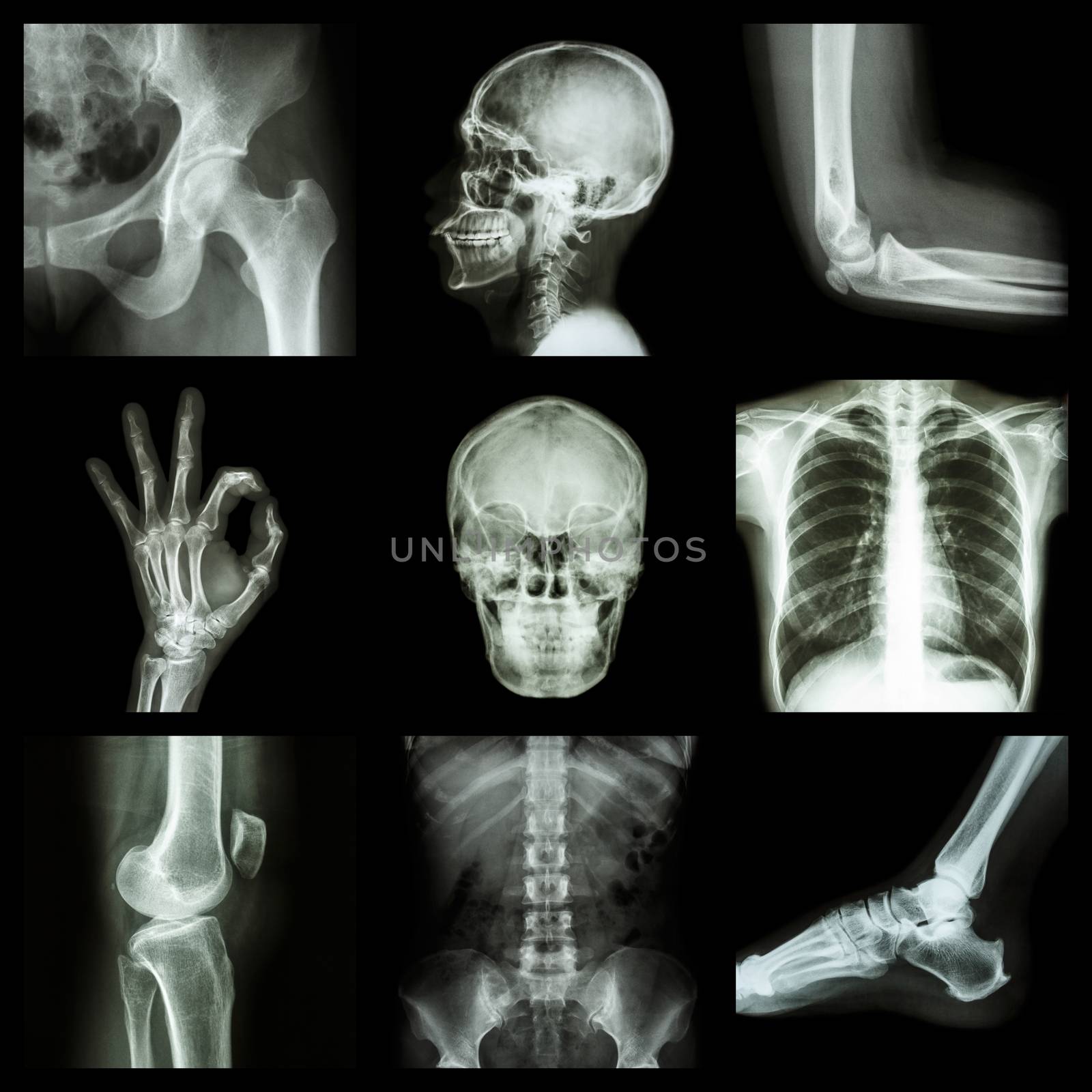 Collection X-ray part of human