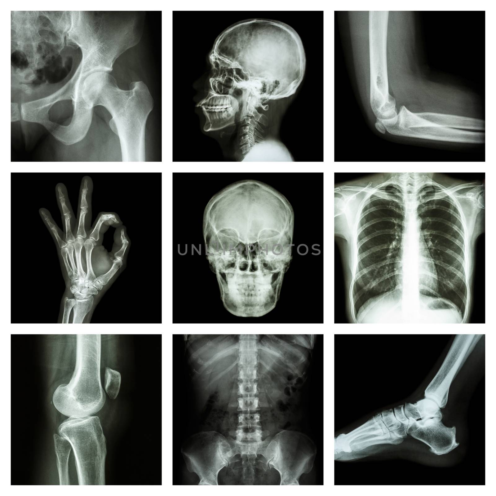 Collection X-ray part of human by stockdevil