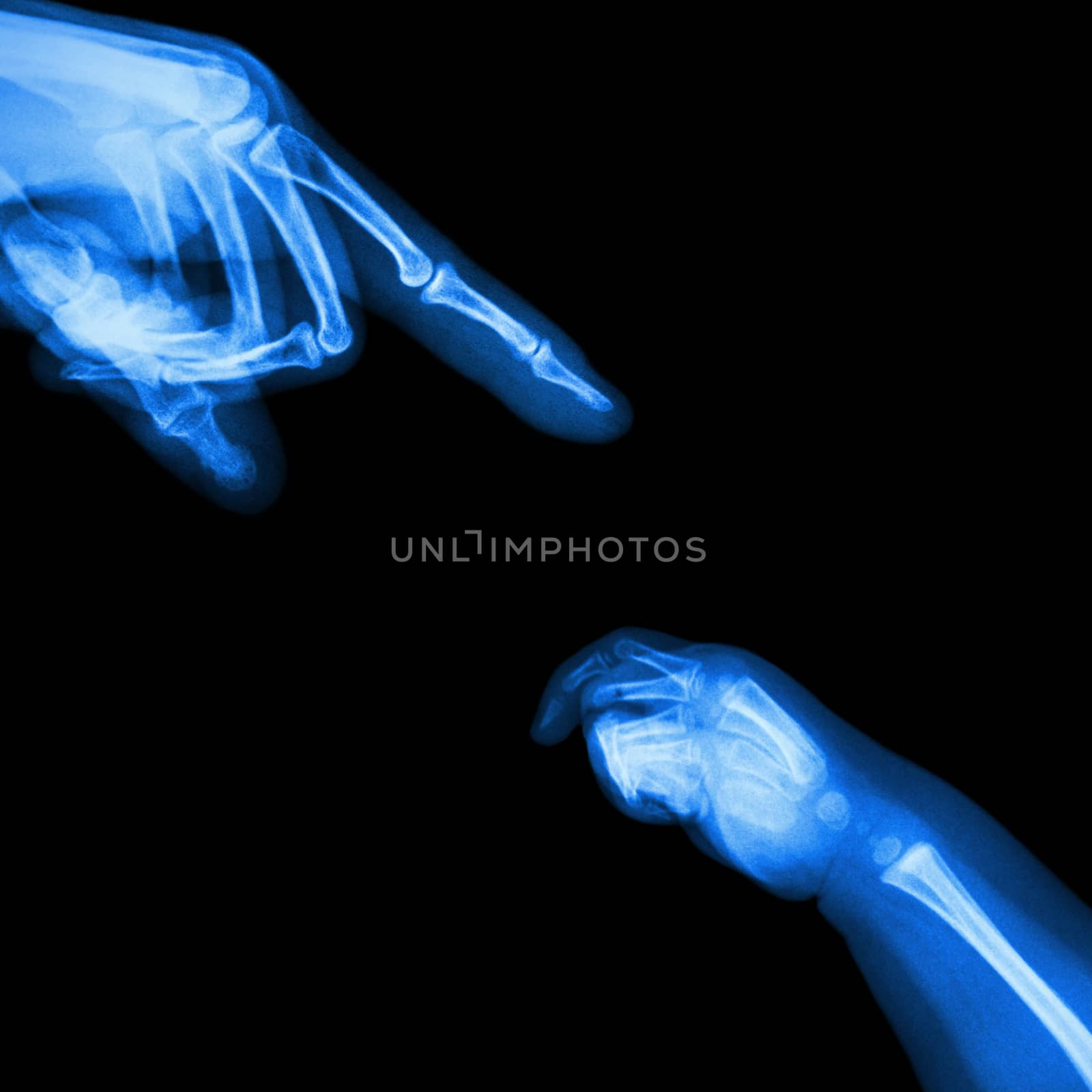 X-ray adult's hand point finger at upper side and baby's hand at lower side by stockdevil