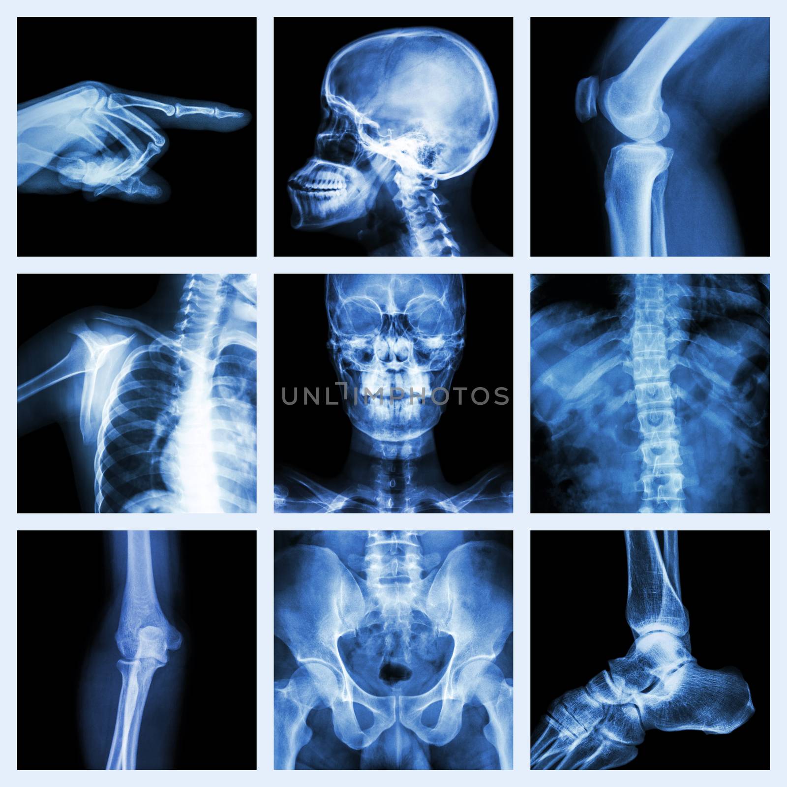 Collection X-ray part of human (Version 2) by stockdevil