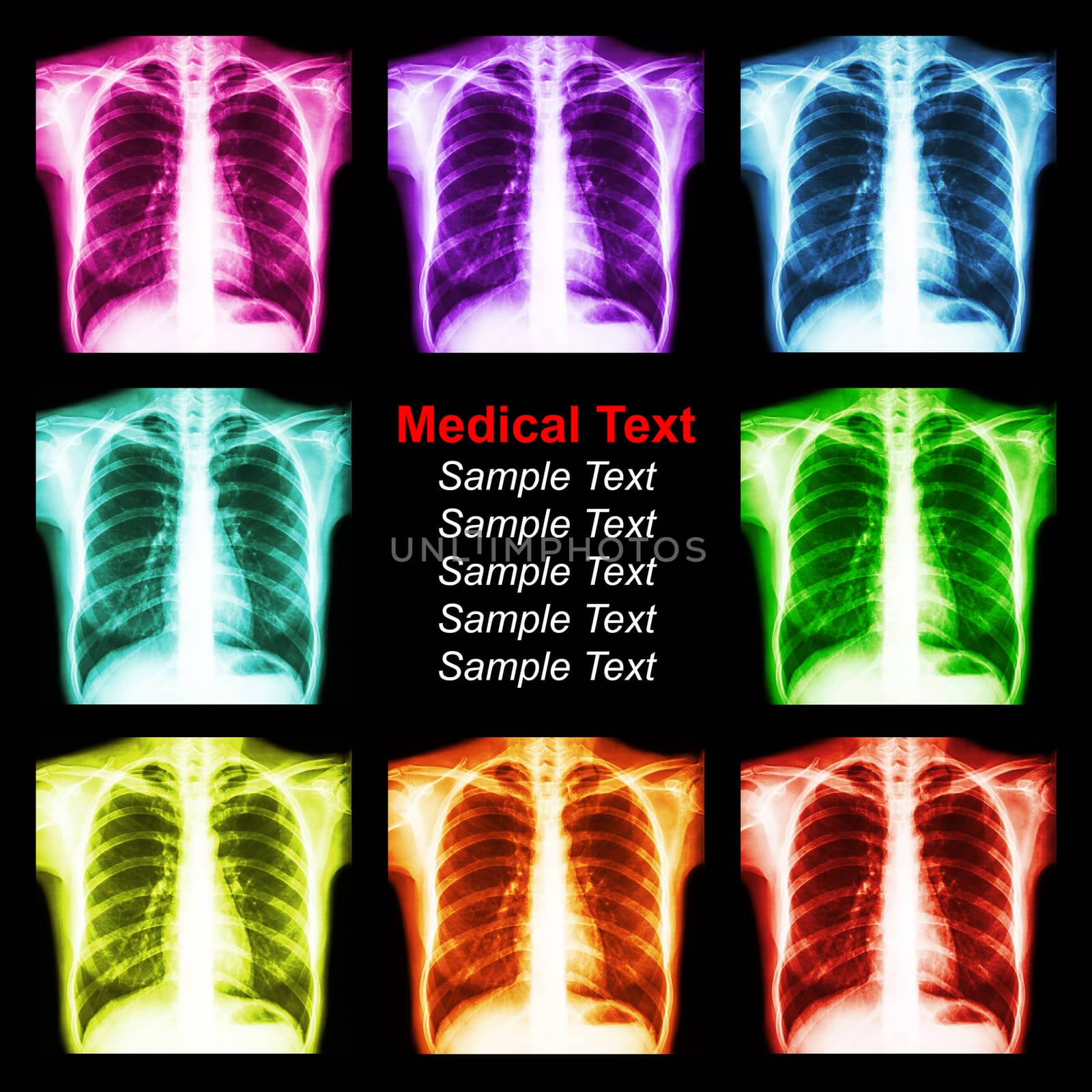 Multicolored chest x-ray background by stockdevil