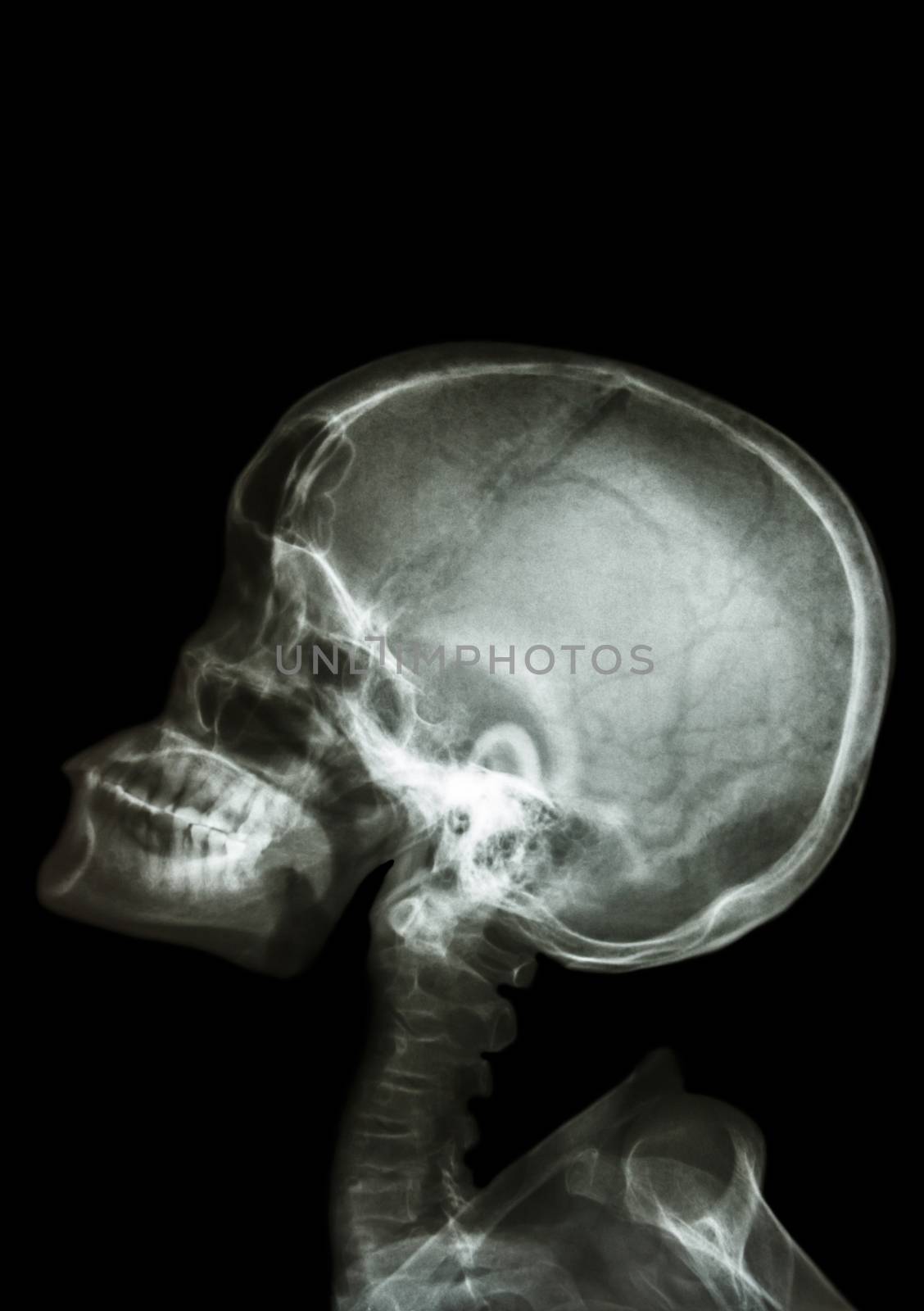 X-ray asian kid look up and blank area at upper side
