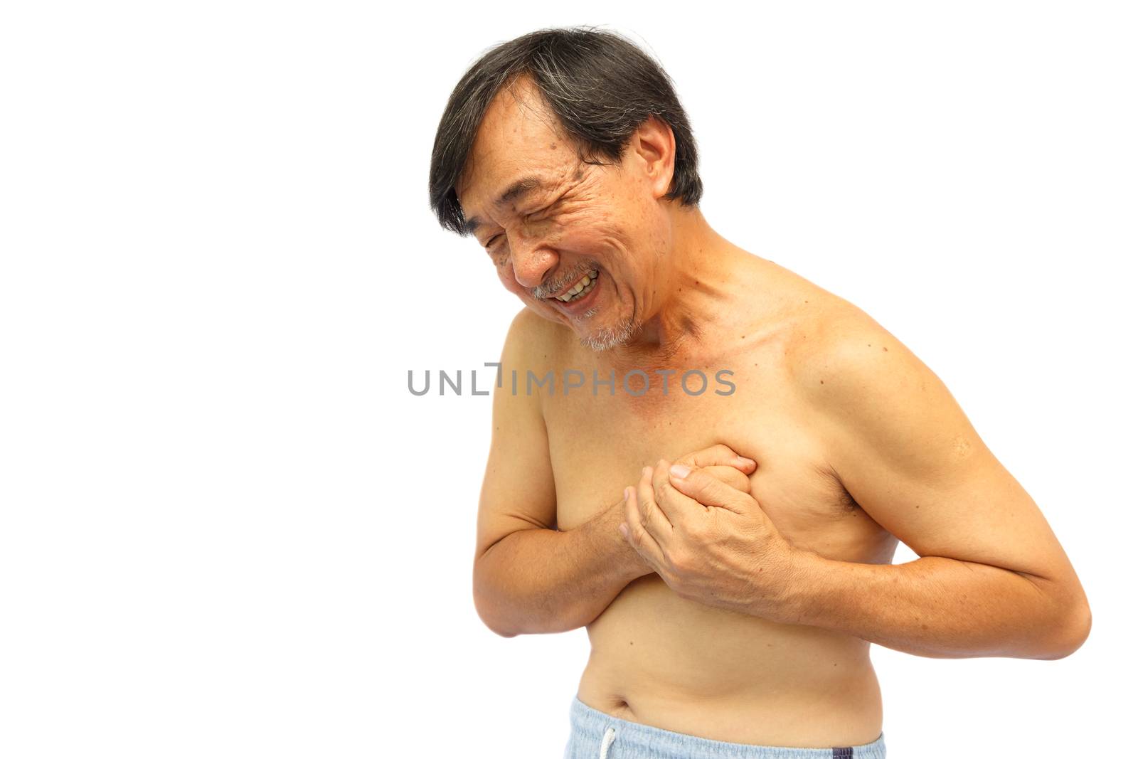 "Myocadial infarction" (Ischemic heart disease). Old aged thai man pain at chest (Angina pectoris)