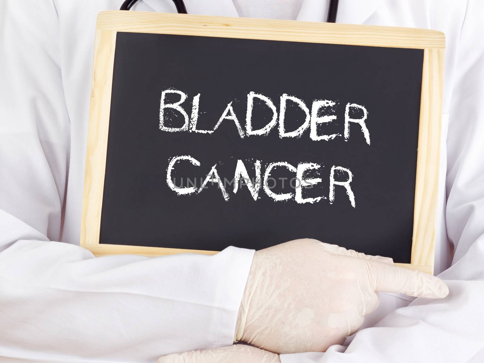 Doctor shows information on blackboard: bladder cancer