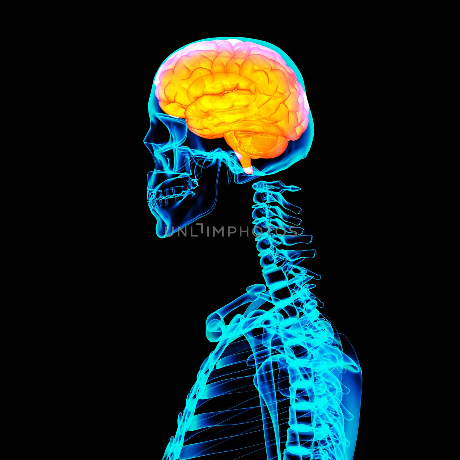 Human red brain X ray by maya2008