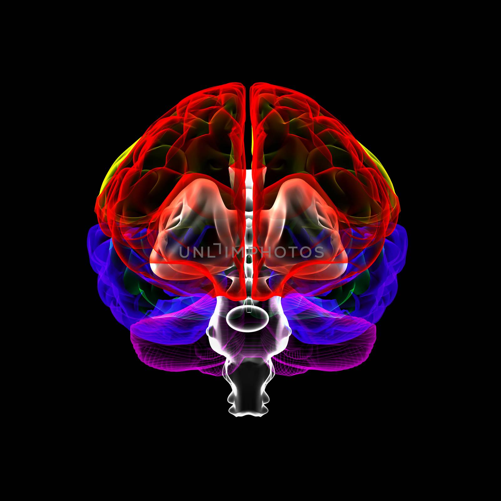 Human brain in x-ray by maya2008