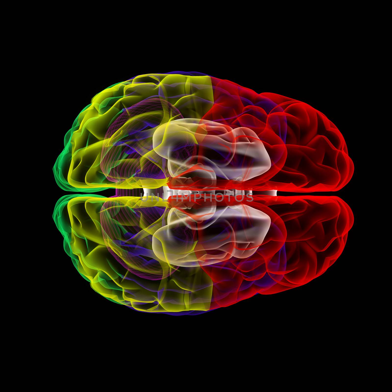 Human brain in x-ray by maya2008