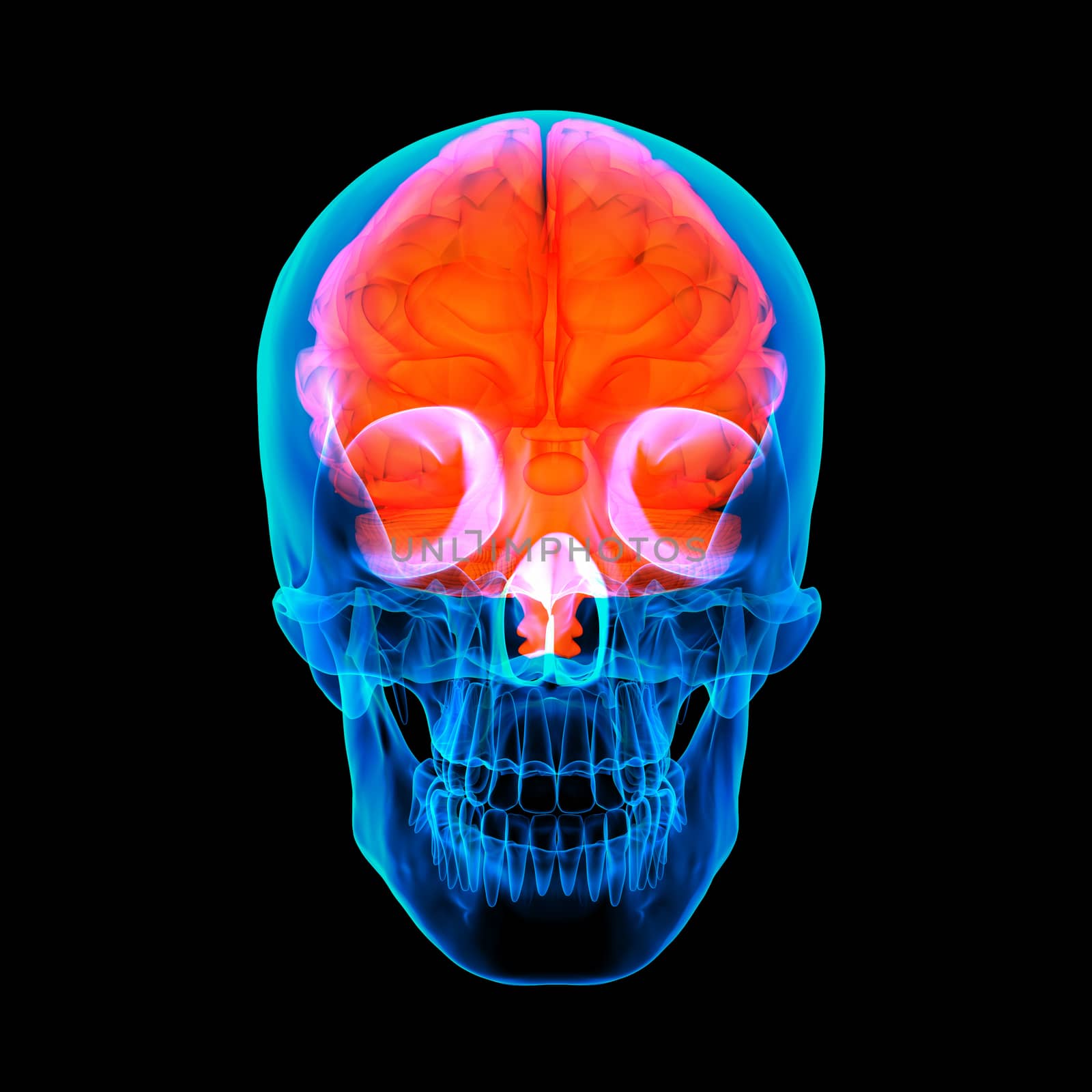 Human red brain X ray - front view