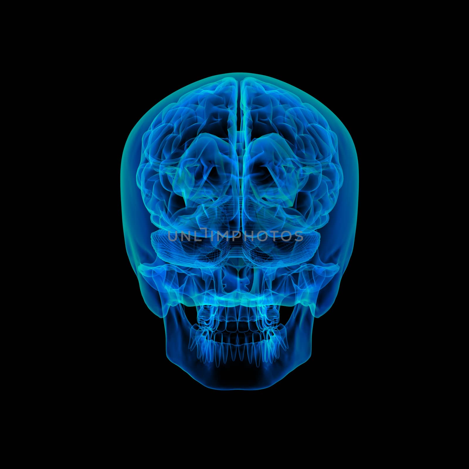 Human brain X ray -  back view
