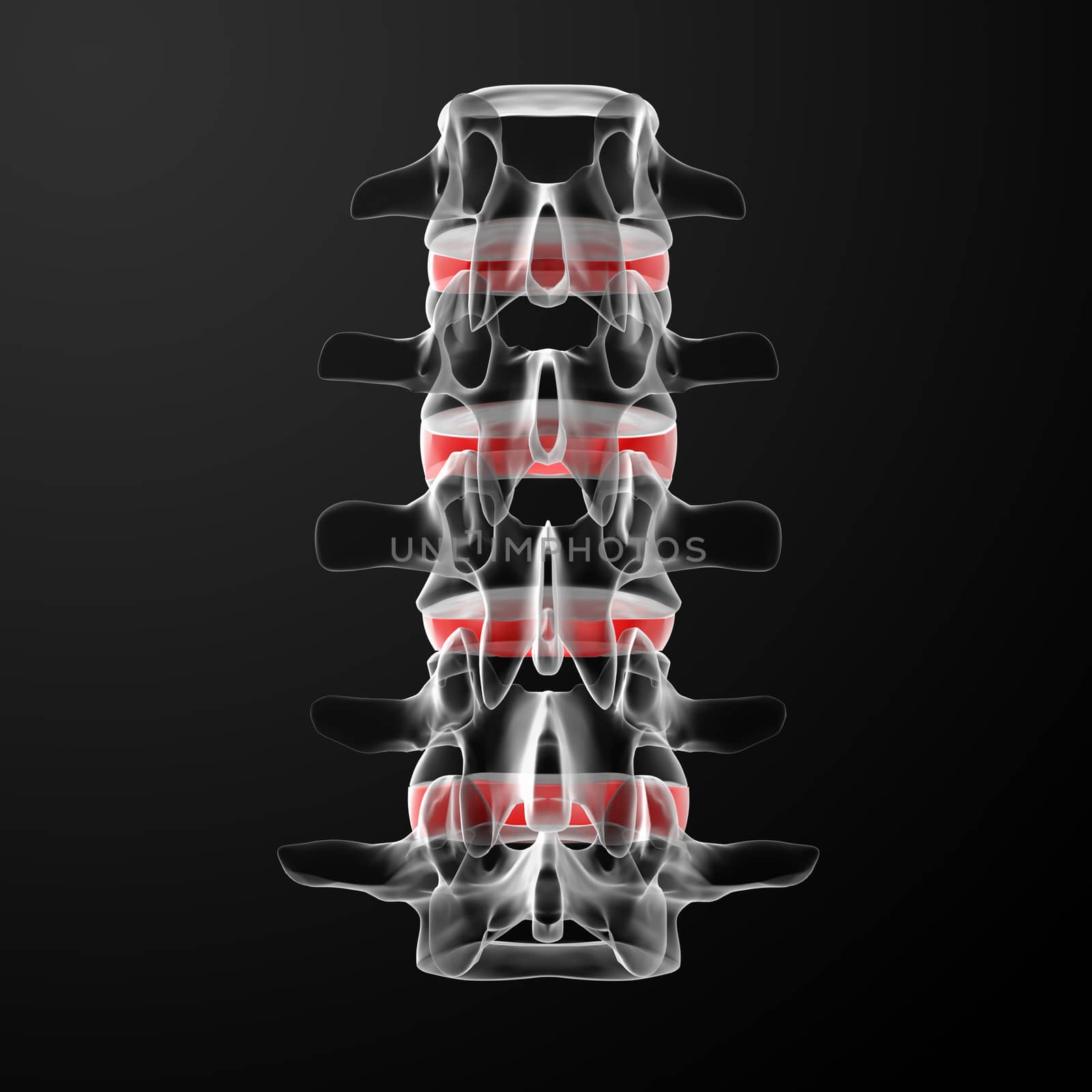 3d render human intervertebral discs - back view