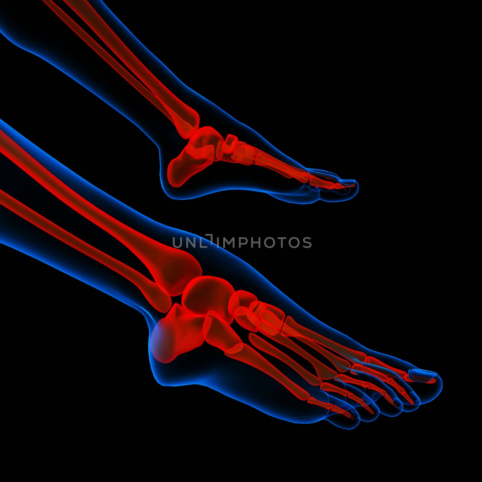 Human foot pain with the anatomy of a skeleton foot