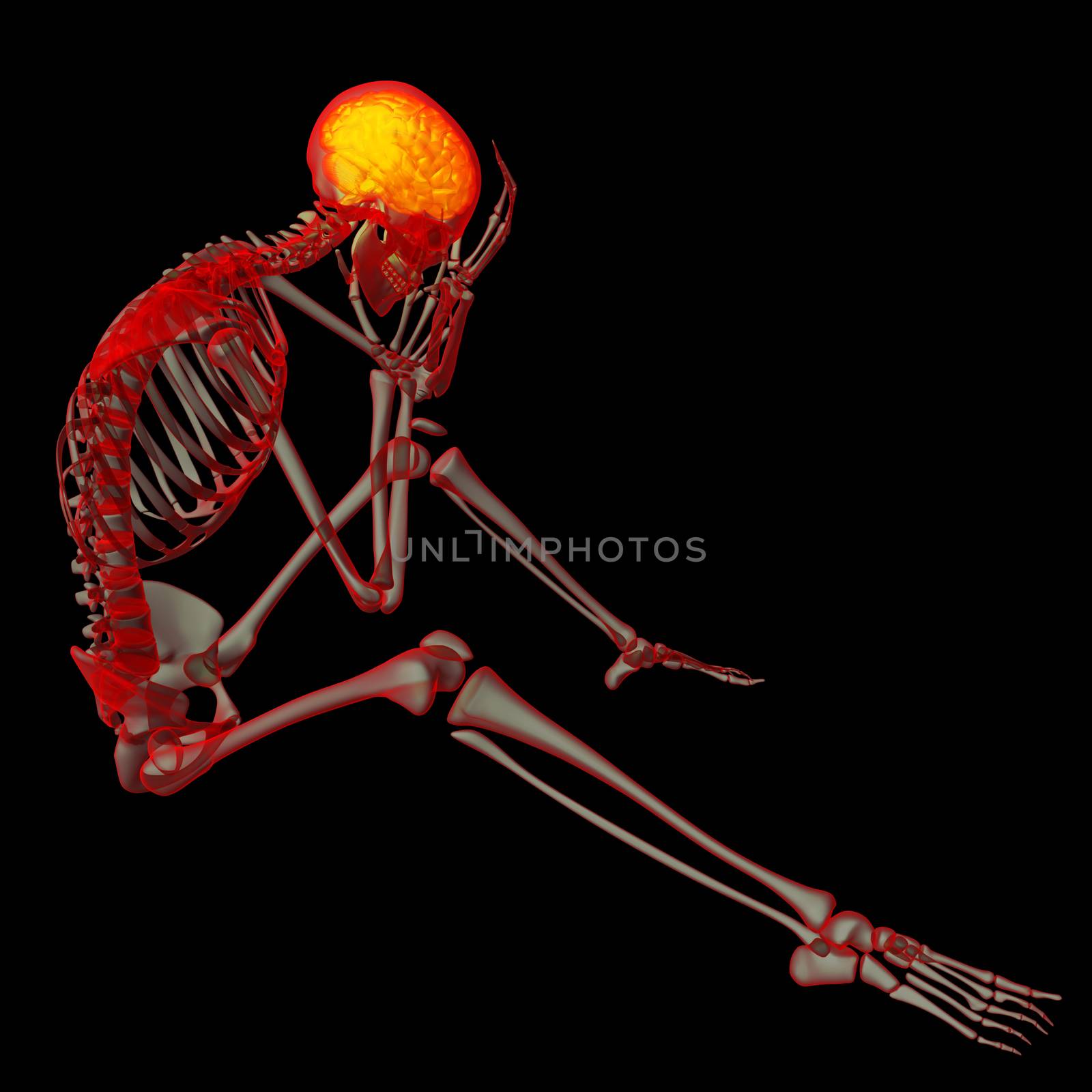 3d rendered orange skeleton of a sitting - headache