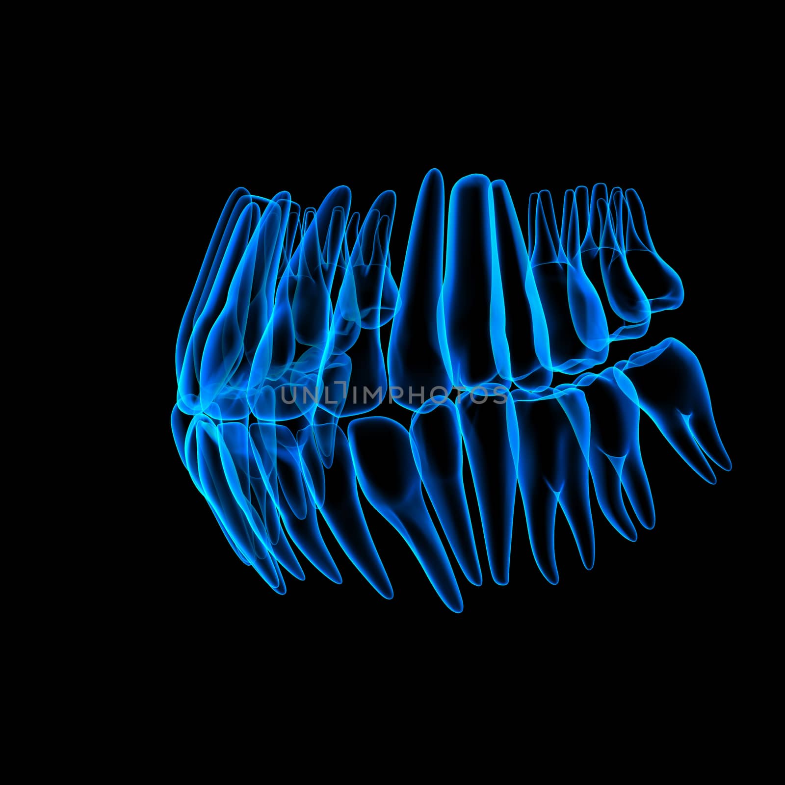 3d human teeth - right front view