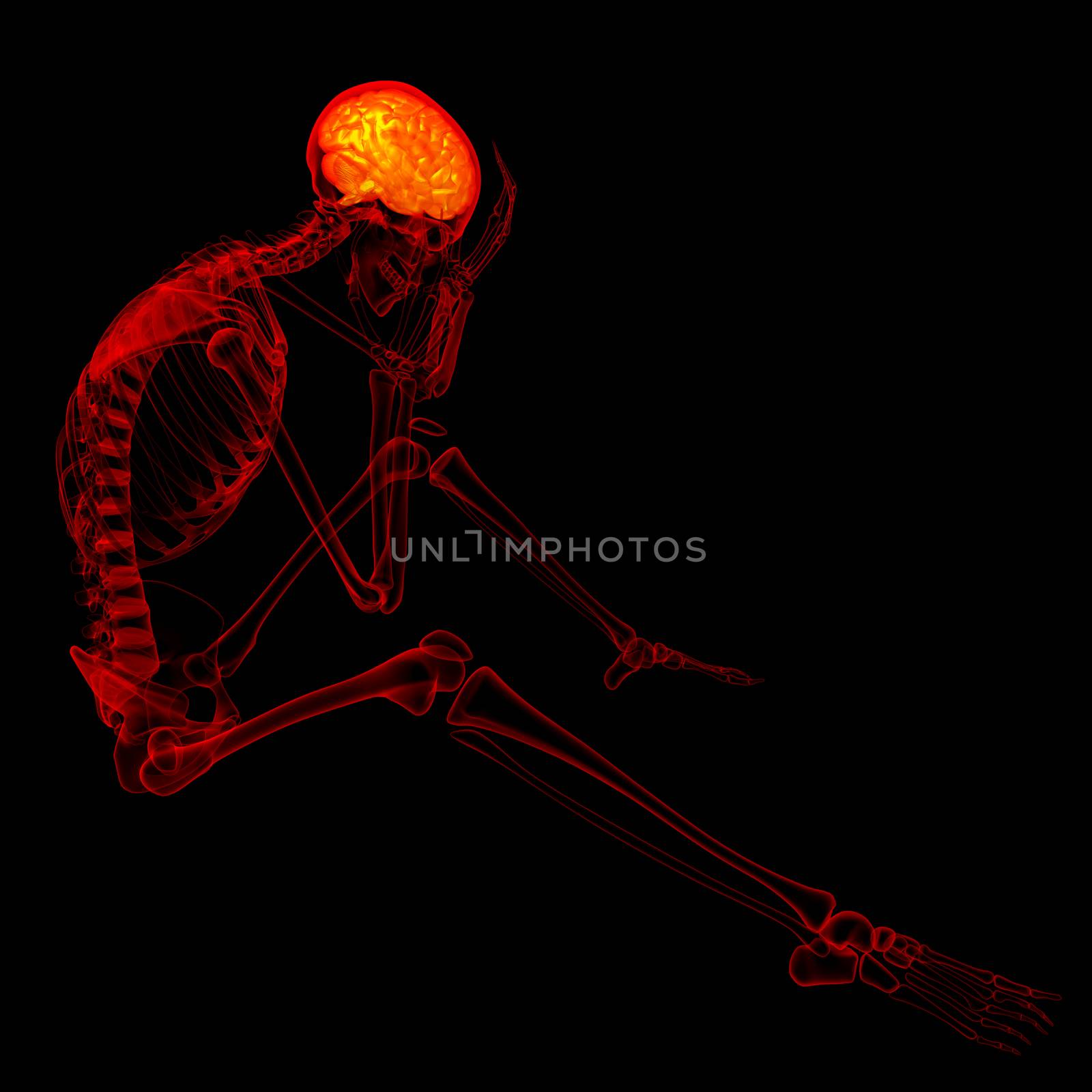 3d rendered red skeleton of a sitting - headache