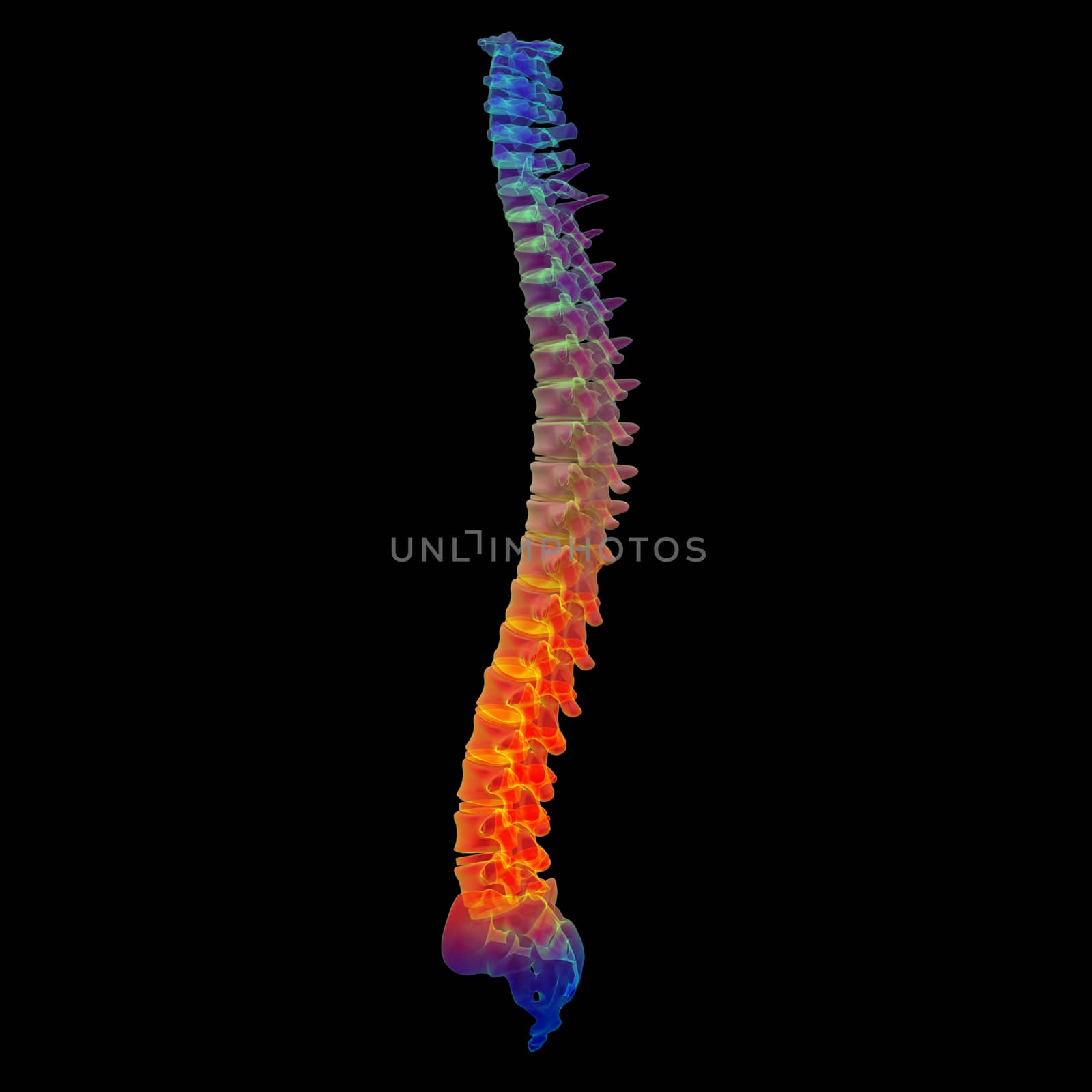 3d render painful spine