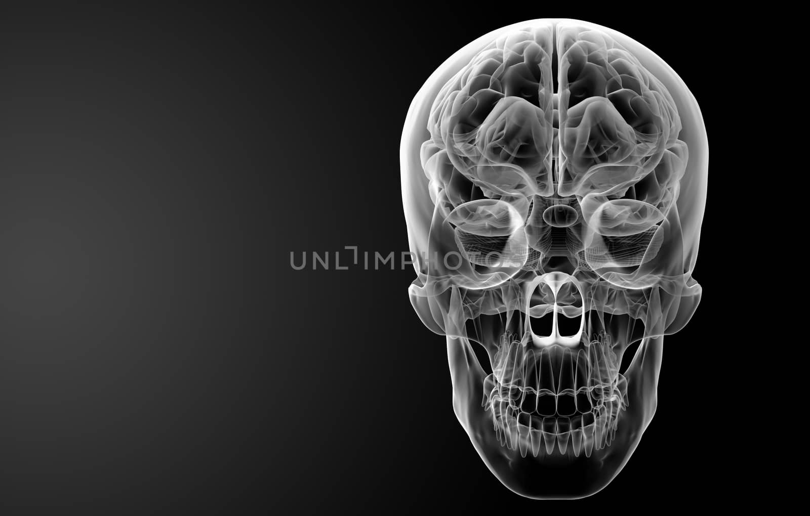 Human brain X ray - front view