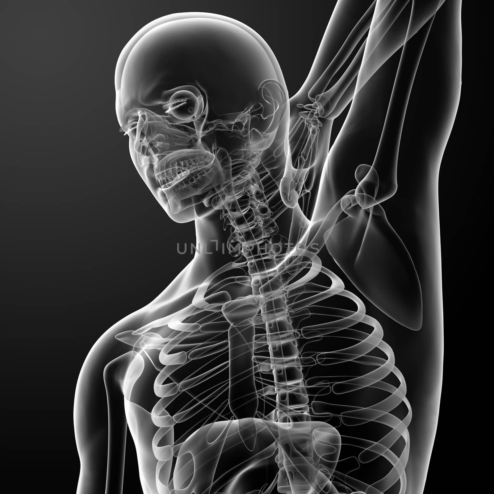 3d rendered illustration - pain neck