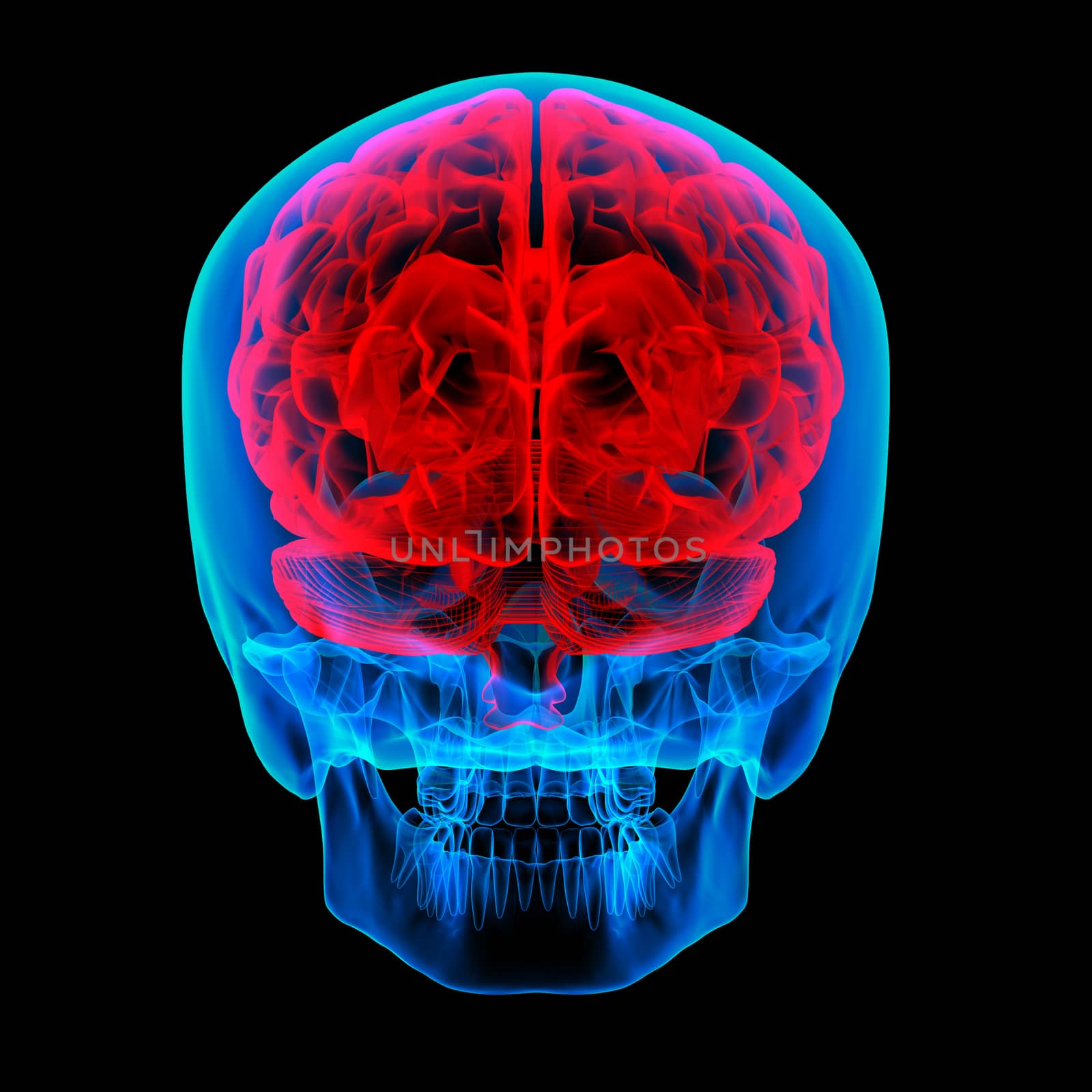 Human brain X ray - back view