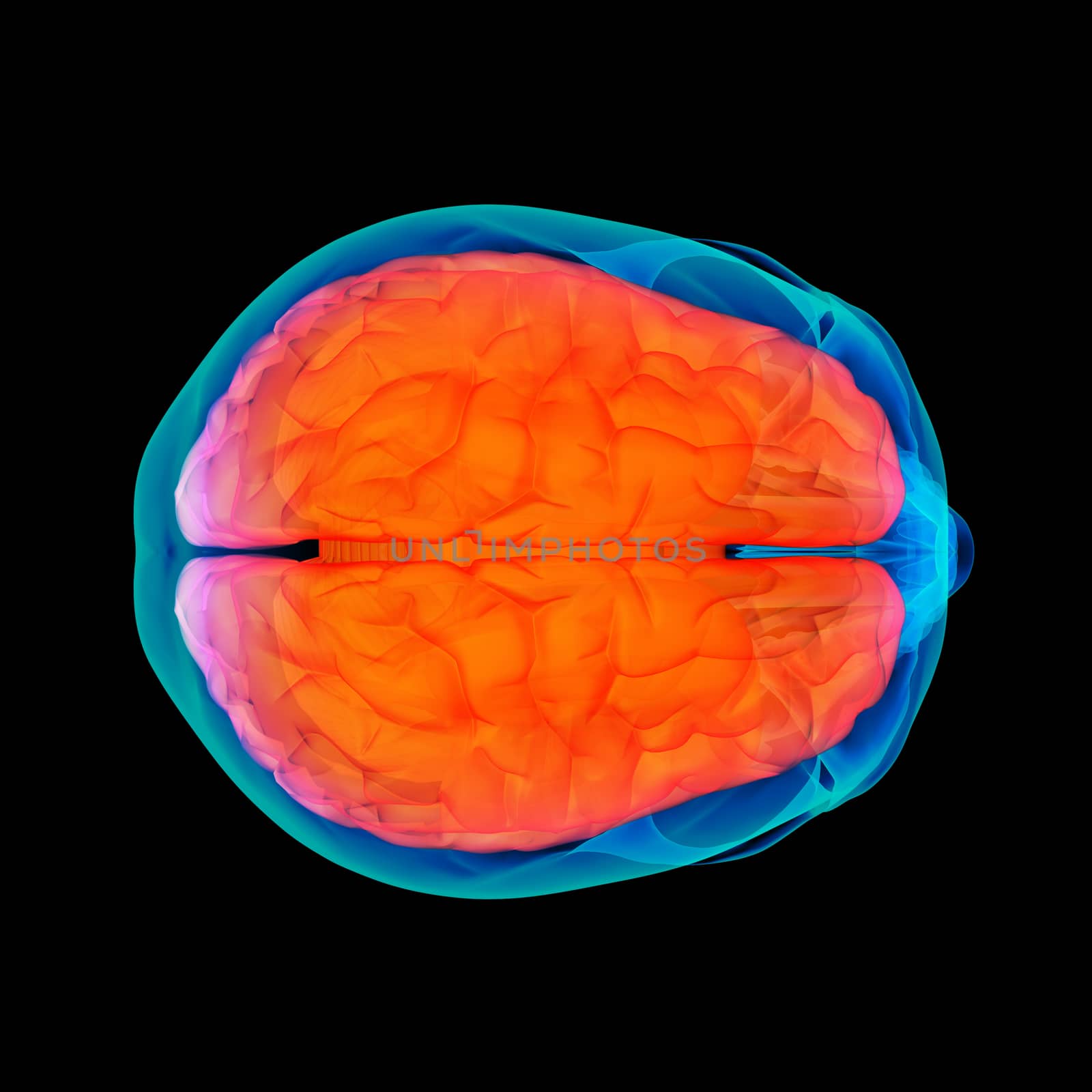 Human brain X ray - side view