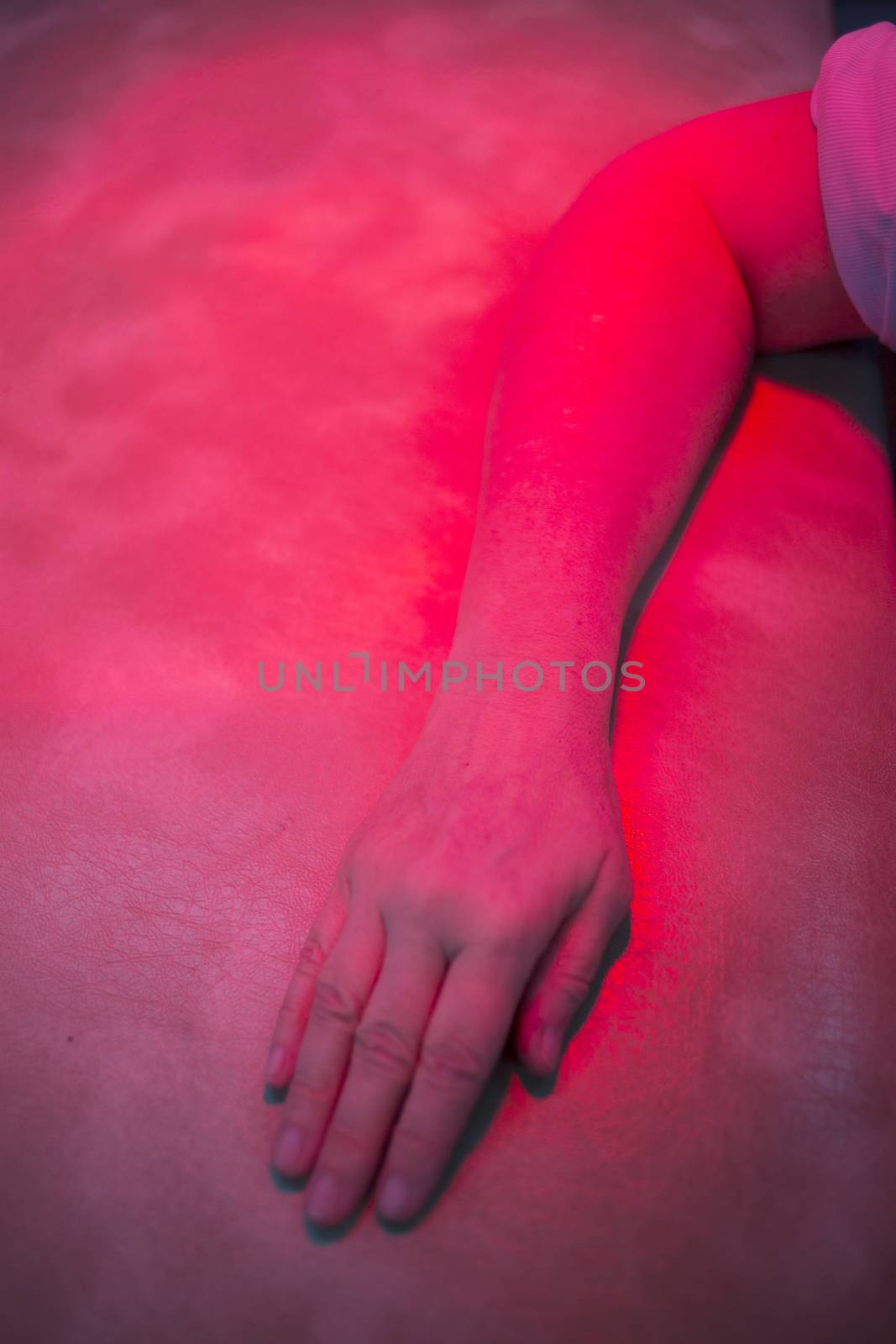 Hand, forearm and arm of injured patient receiving treamente under red physiotherapy rehabilitation hospital clinic heat lamp. 