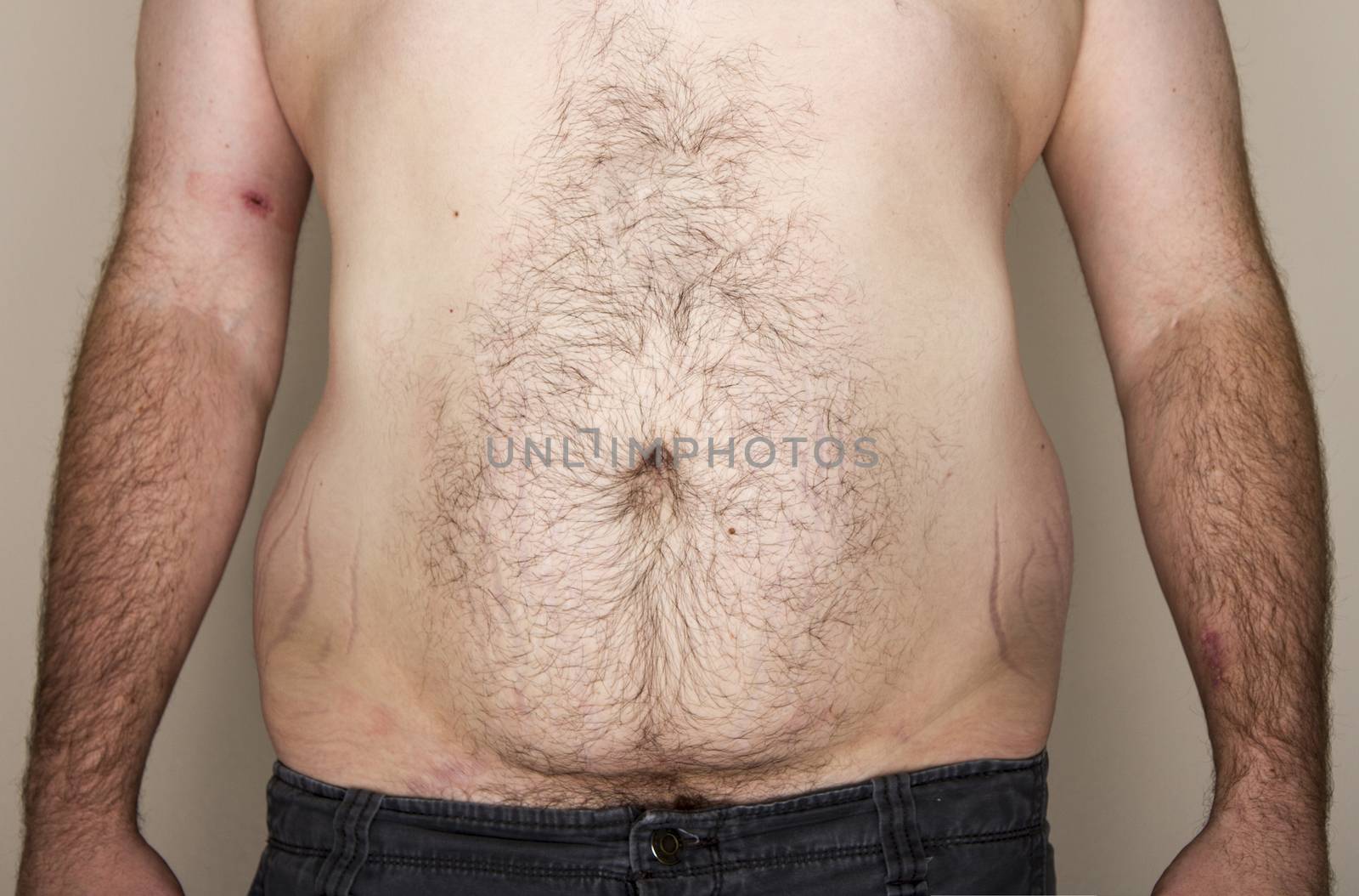 Midsection of an overweight obese male facing the camera