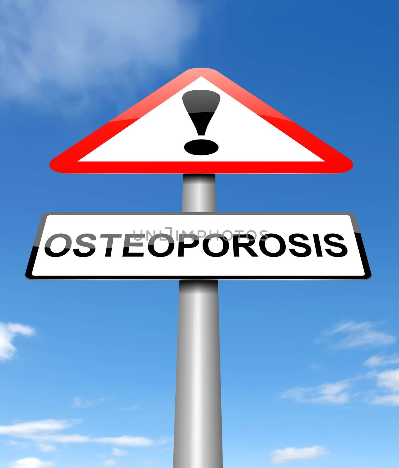 Illustration depicting a sign with an osteoporosis concept.