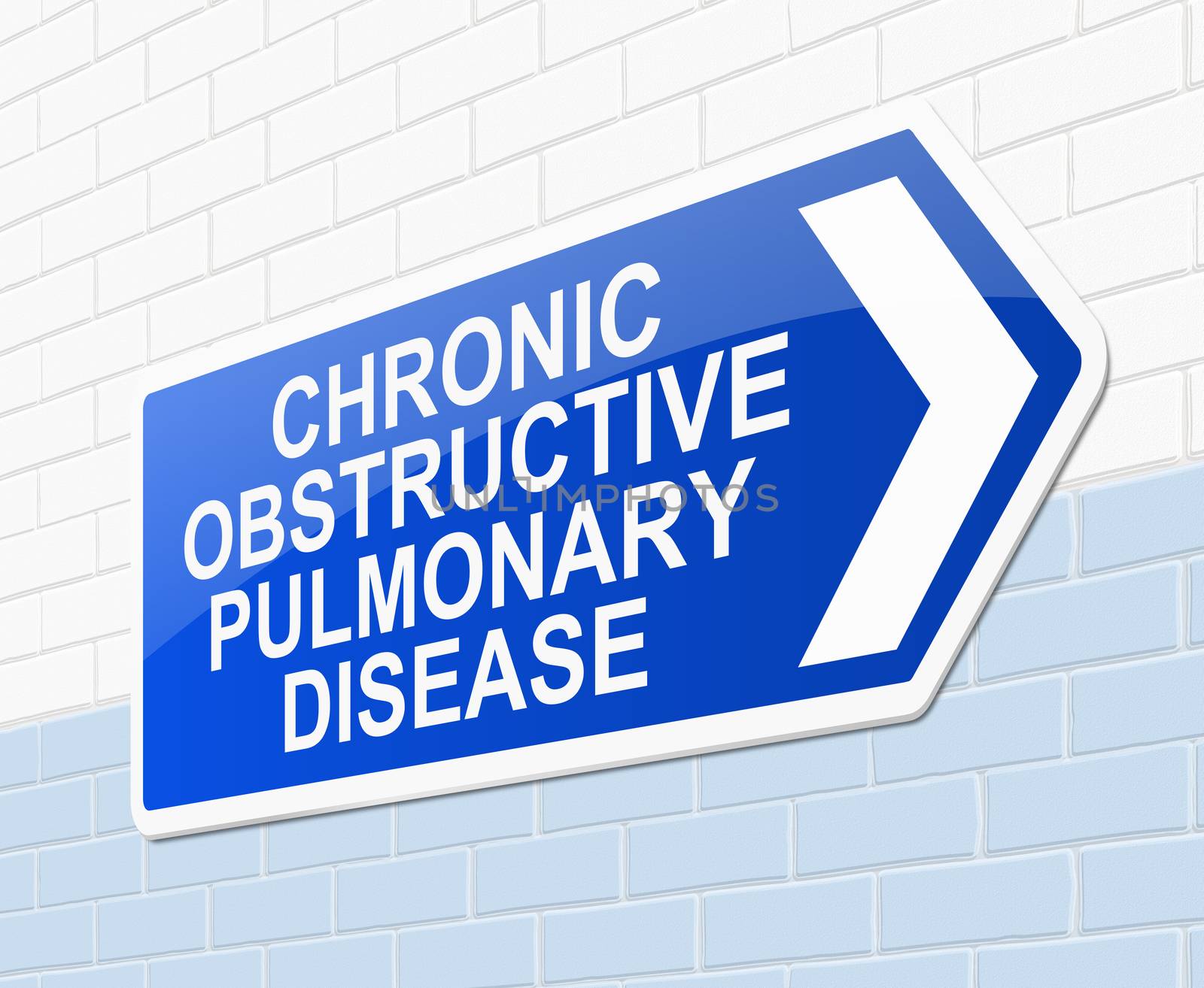 Illustration depicting a sign with a chronic obstructive pulmonary disease concept.