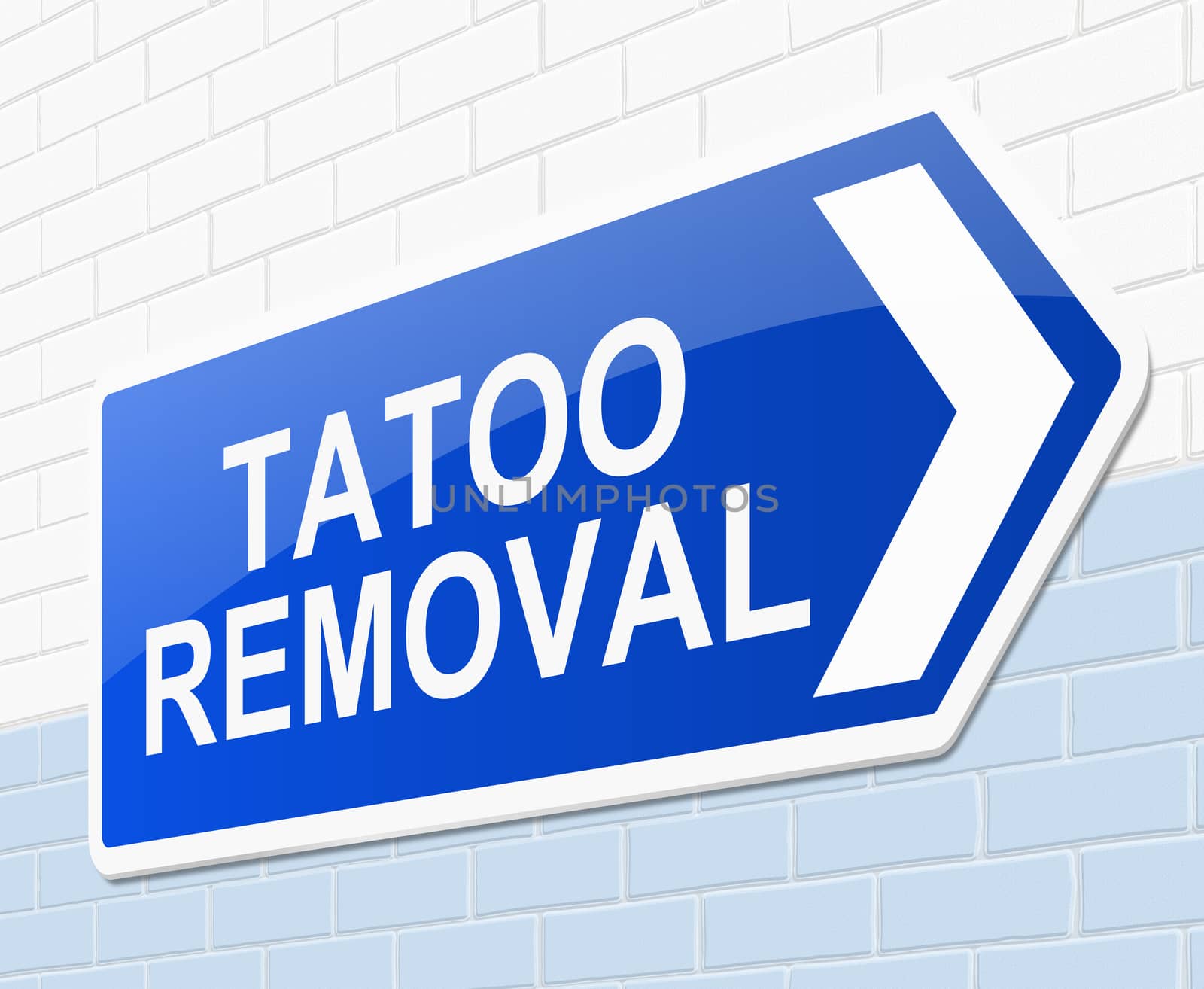 Illustration depicting a sign with a tatoo removal concept.